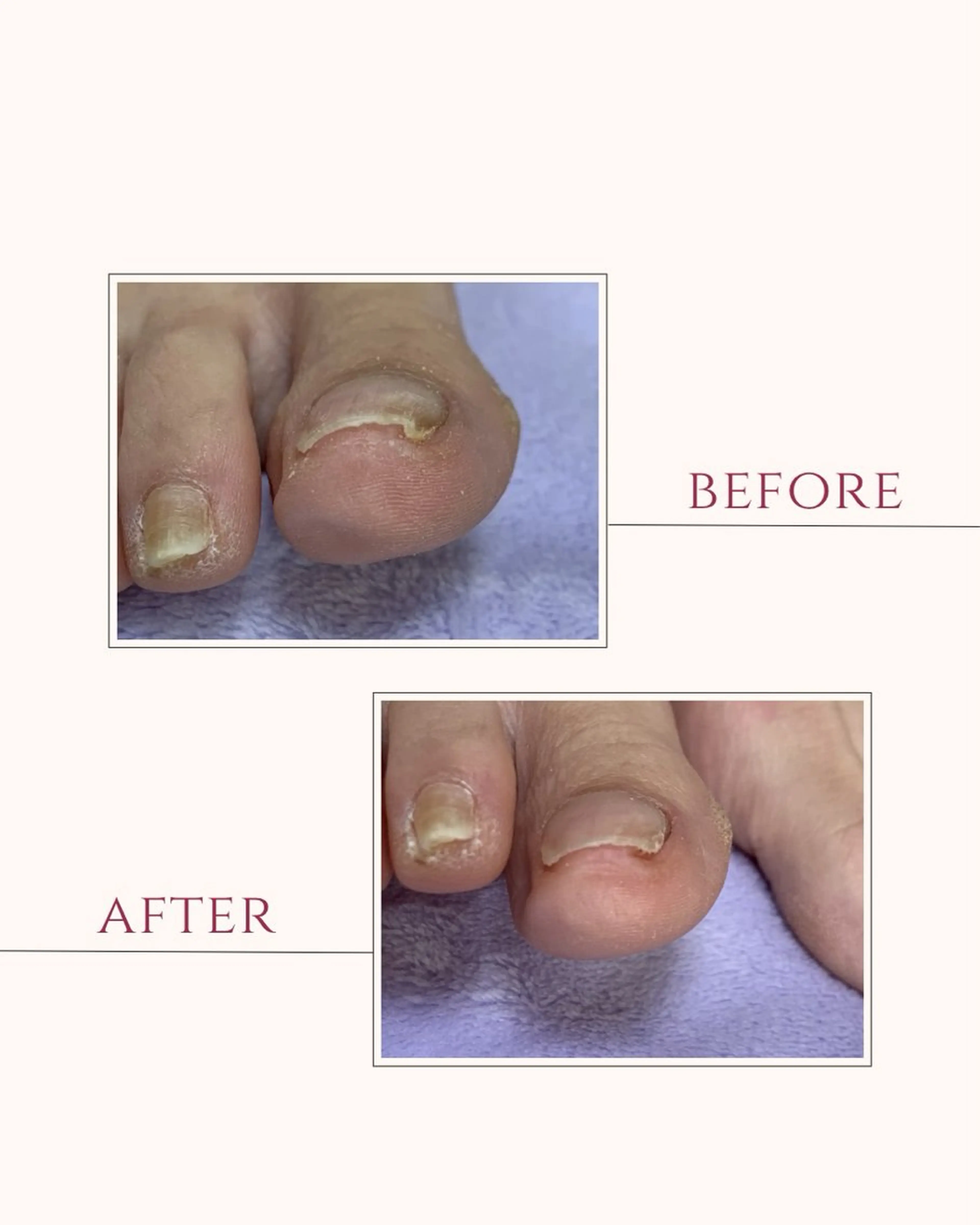 【足トラブル専門店】魚の目・巻き爪 フットケアサロン　ニコルル金沢店所属・足トラブル専門 ニコルル金沢のエステ・リラクイメージ