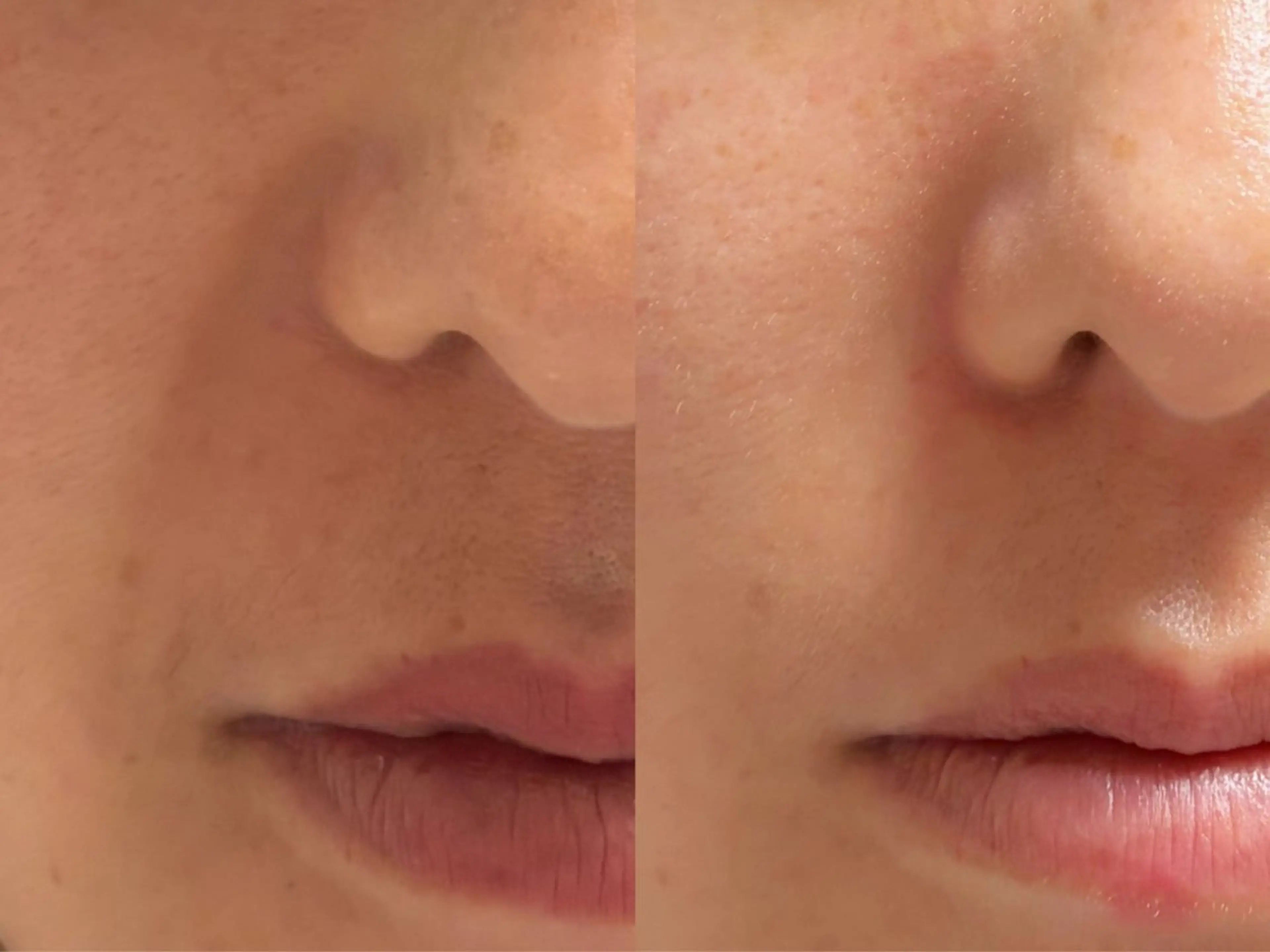 エステ れむりあ 田原のヘアスタイル