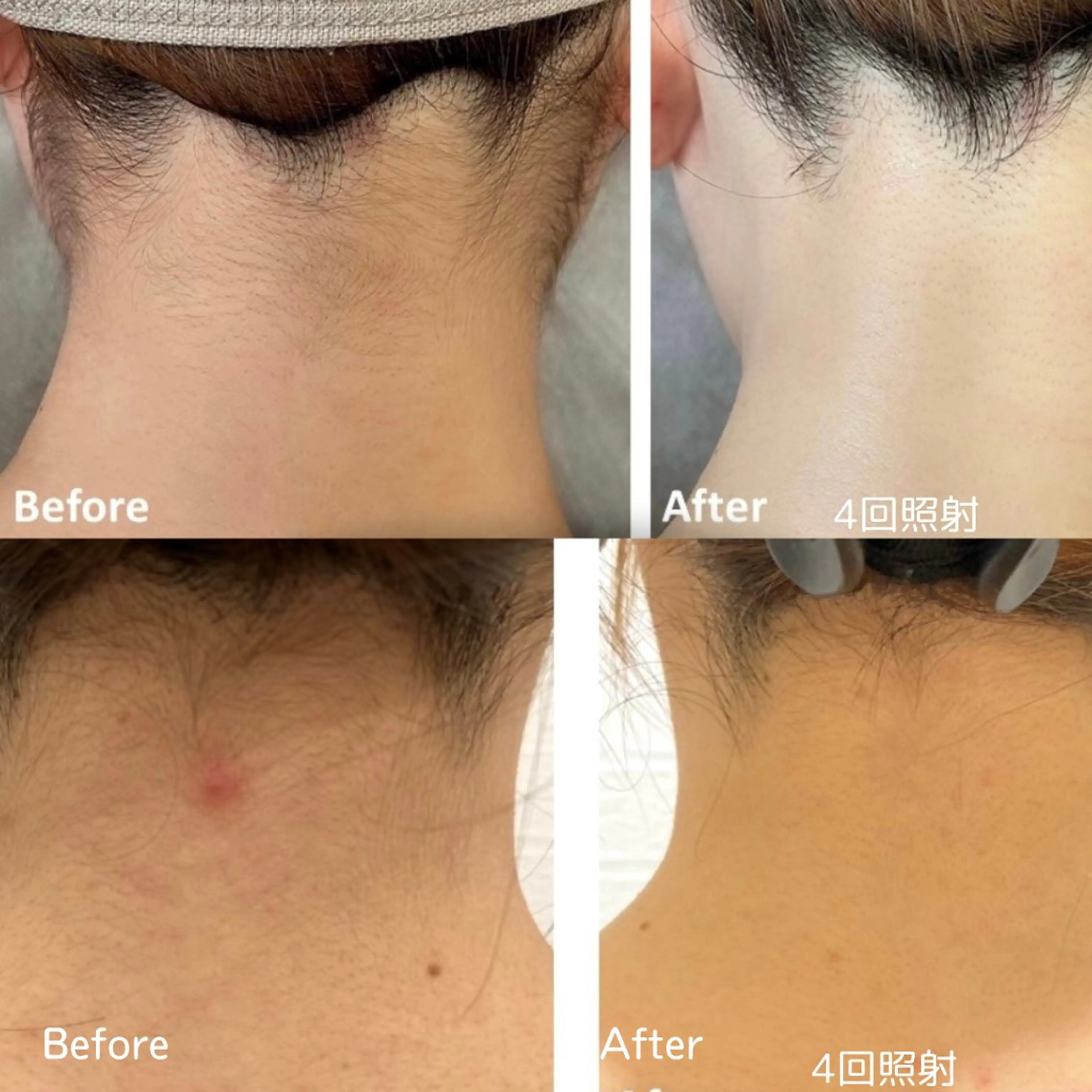 VANILLA SKY所属・VANILLA SKYのエステ・リラクイメージ