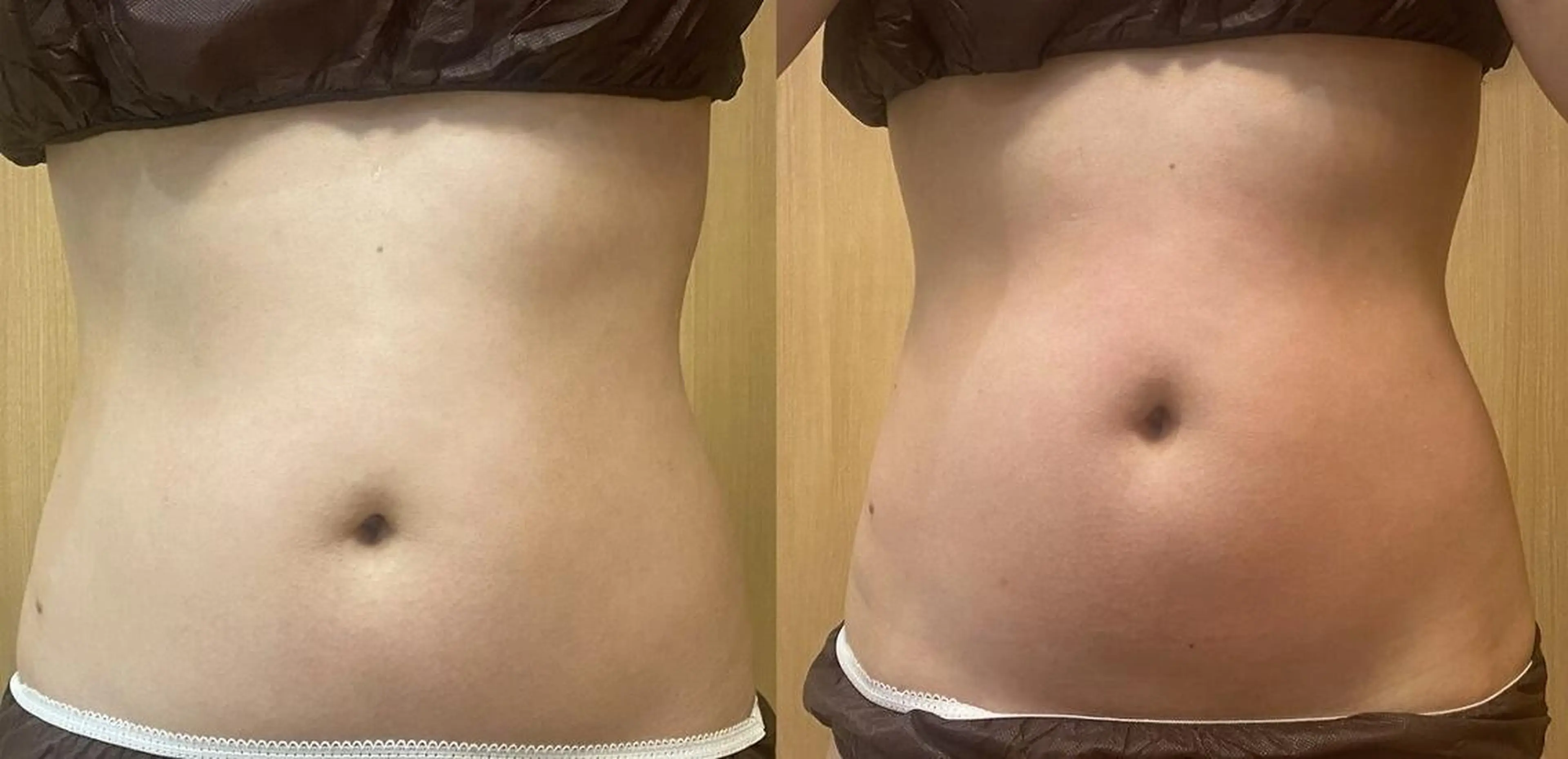 エステ リラク OPREA 千種店のエステ・リラクイメージ