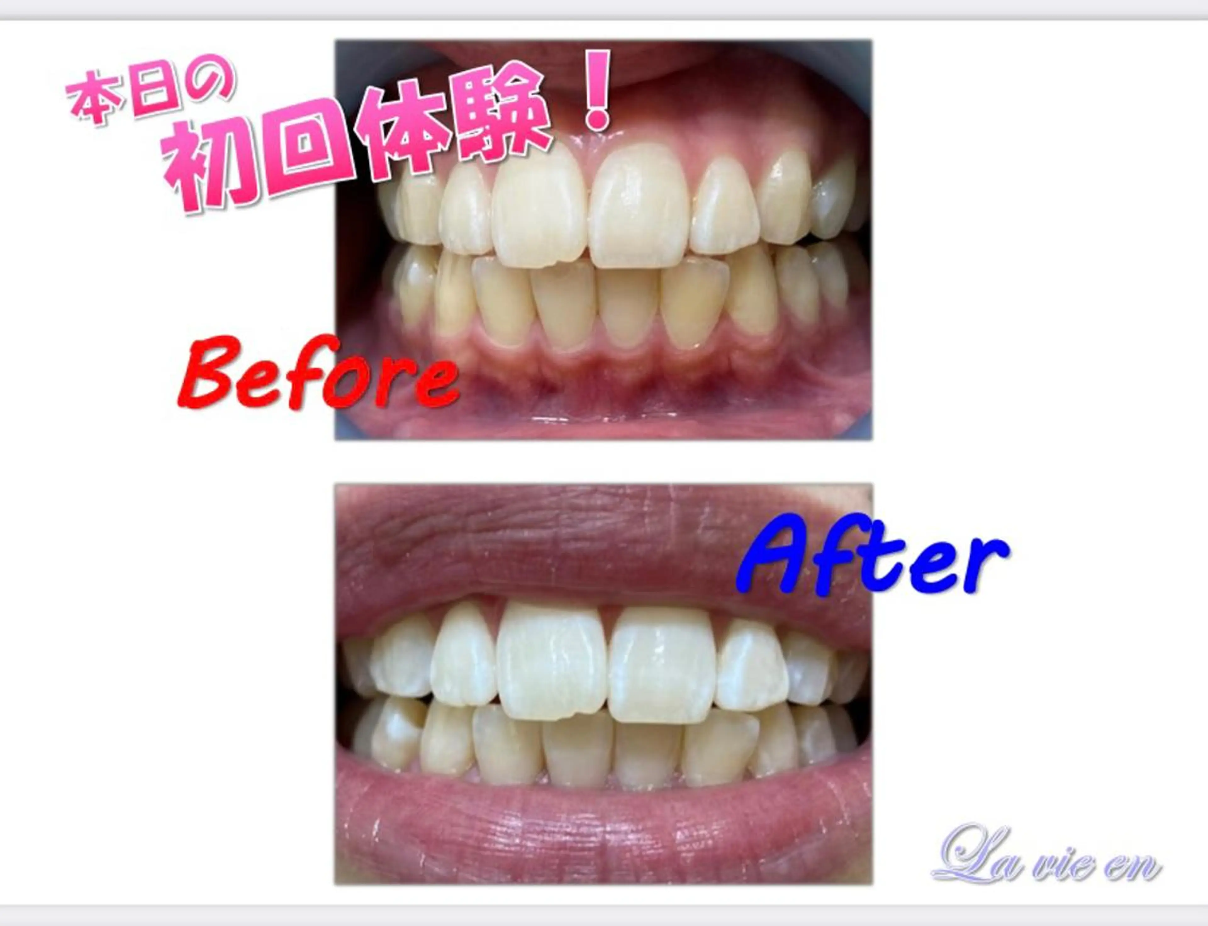 その他 セルフホワイトニングサロン　ラヴィアン所属・ホワイトニングサロン La vie enのその他イメージ