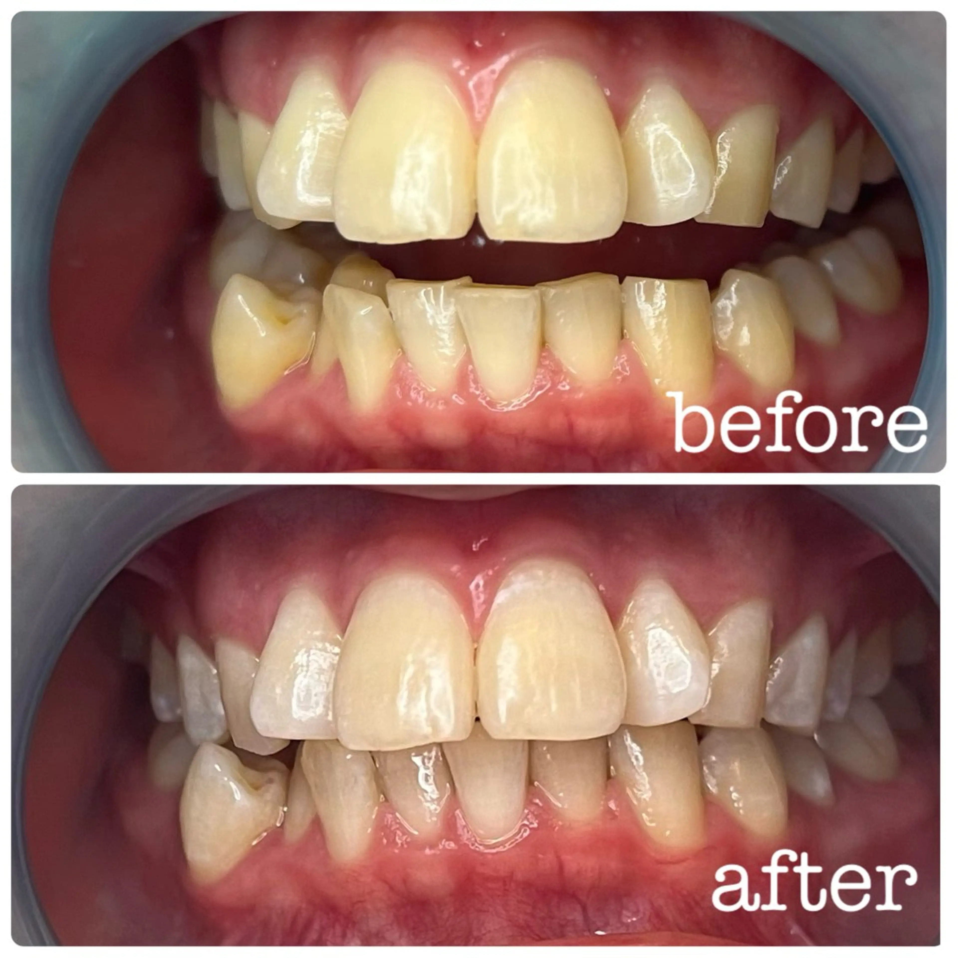 メンズ DH. MISATOの眉毛・アイブロウイメージ