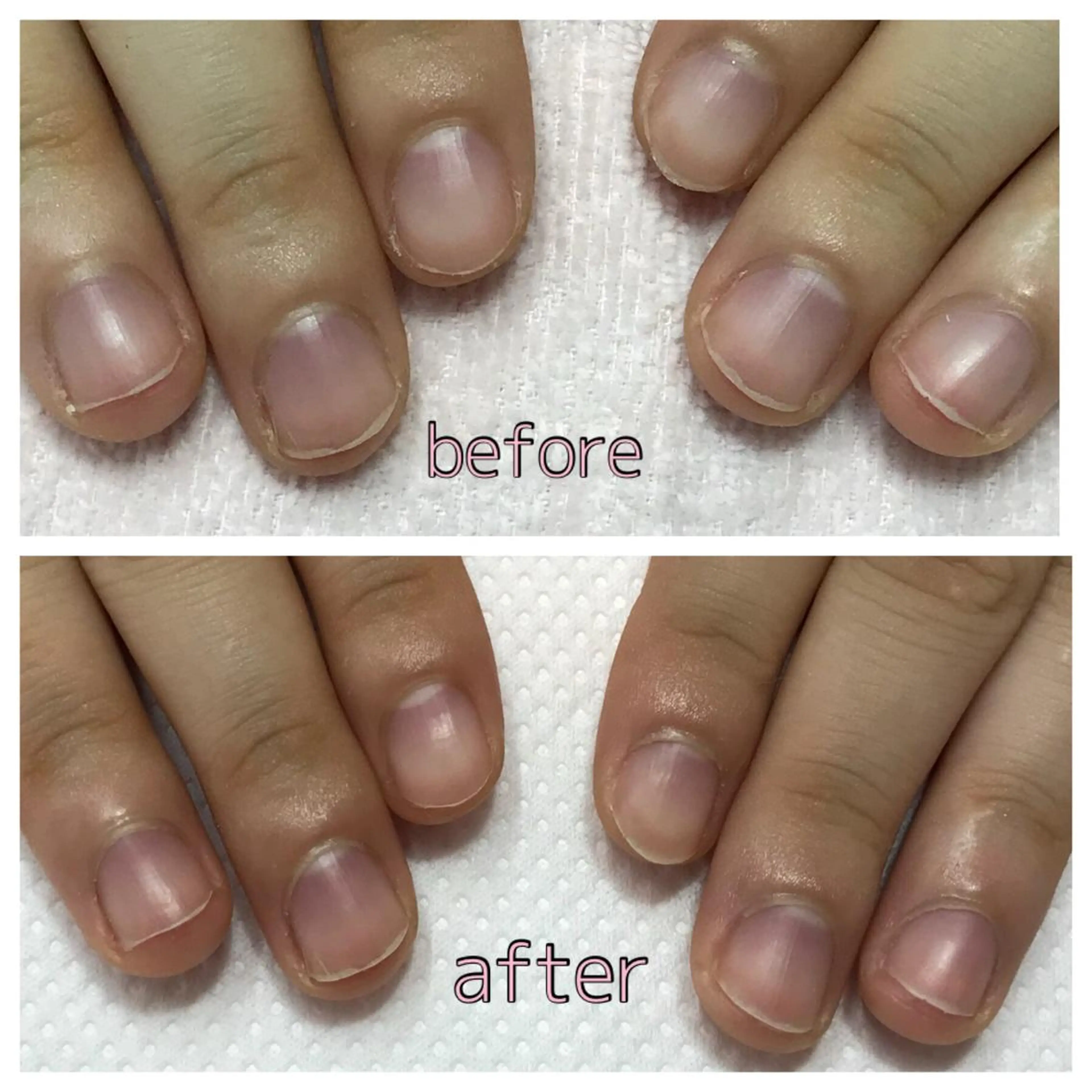 ネイル 山崎 みゆきのネイルデザイン