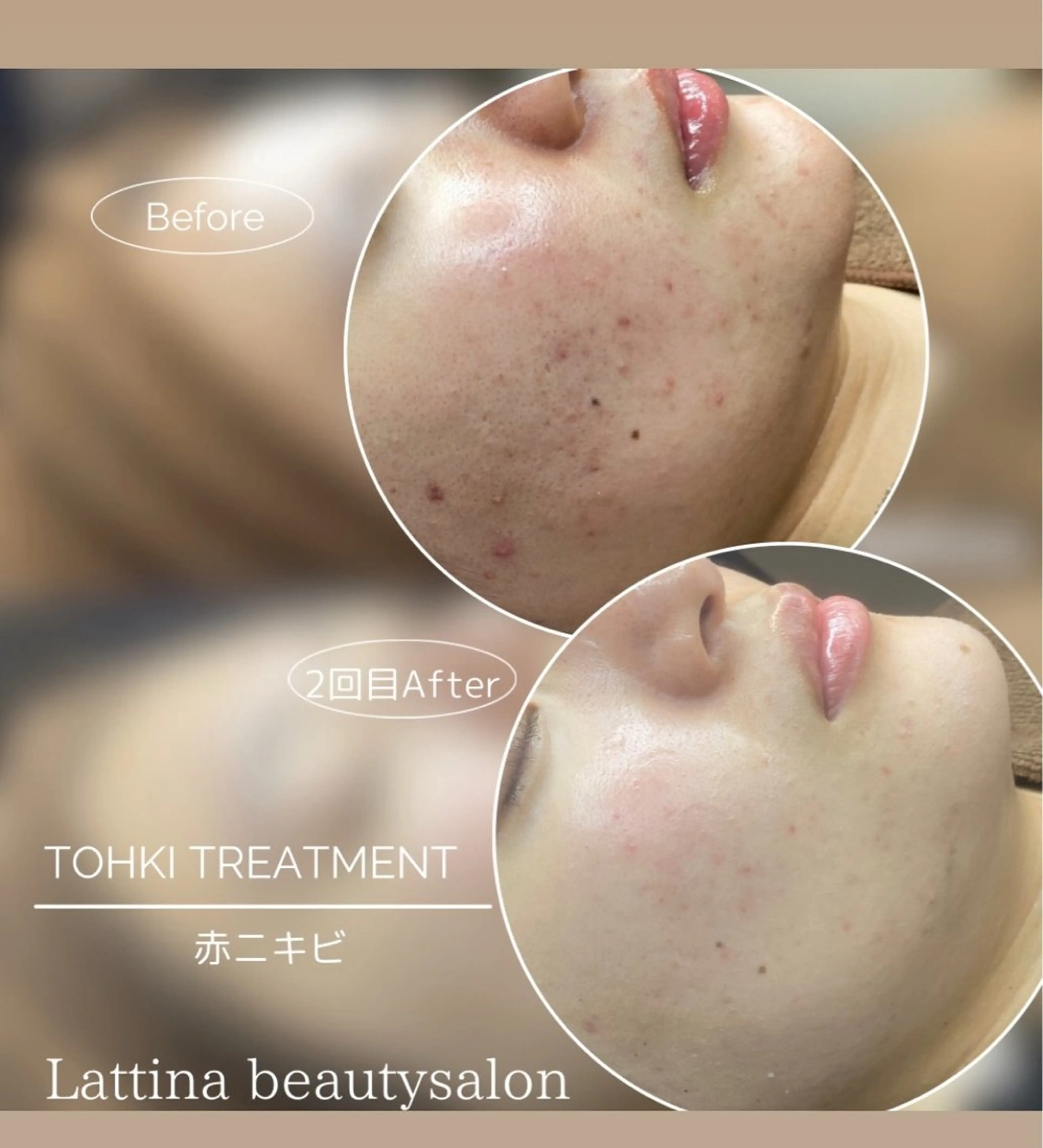 Lattina beautysalon所属・Lattina ラティーナのエステ・リラクイメージ