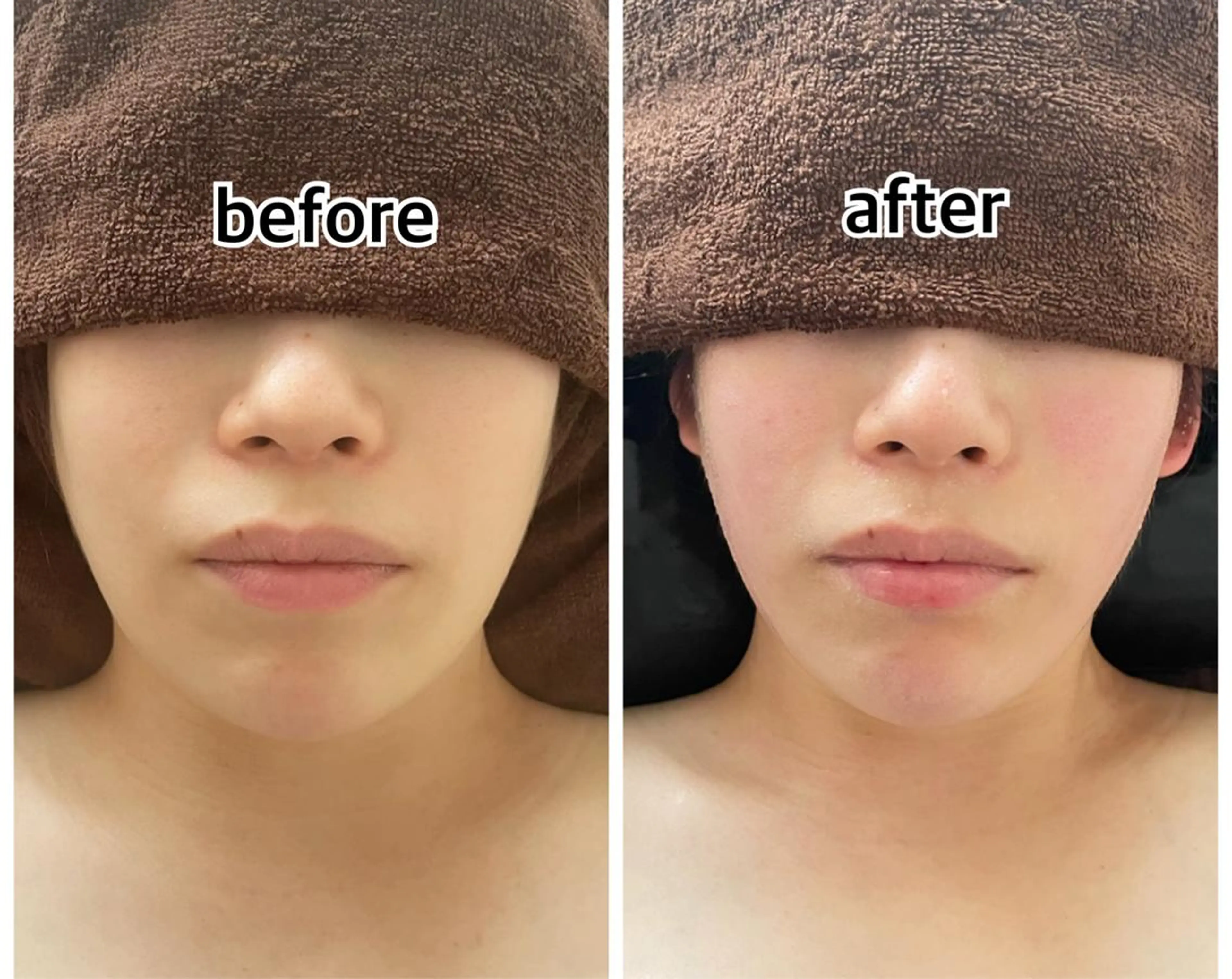 💎インディバ GEM💎indiba healing room GEM所属・💎 GEM💎のエステ・リラクイメージ