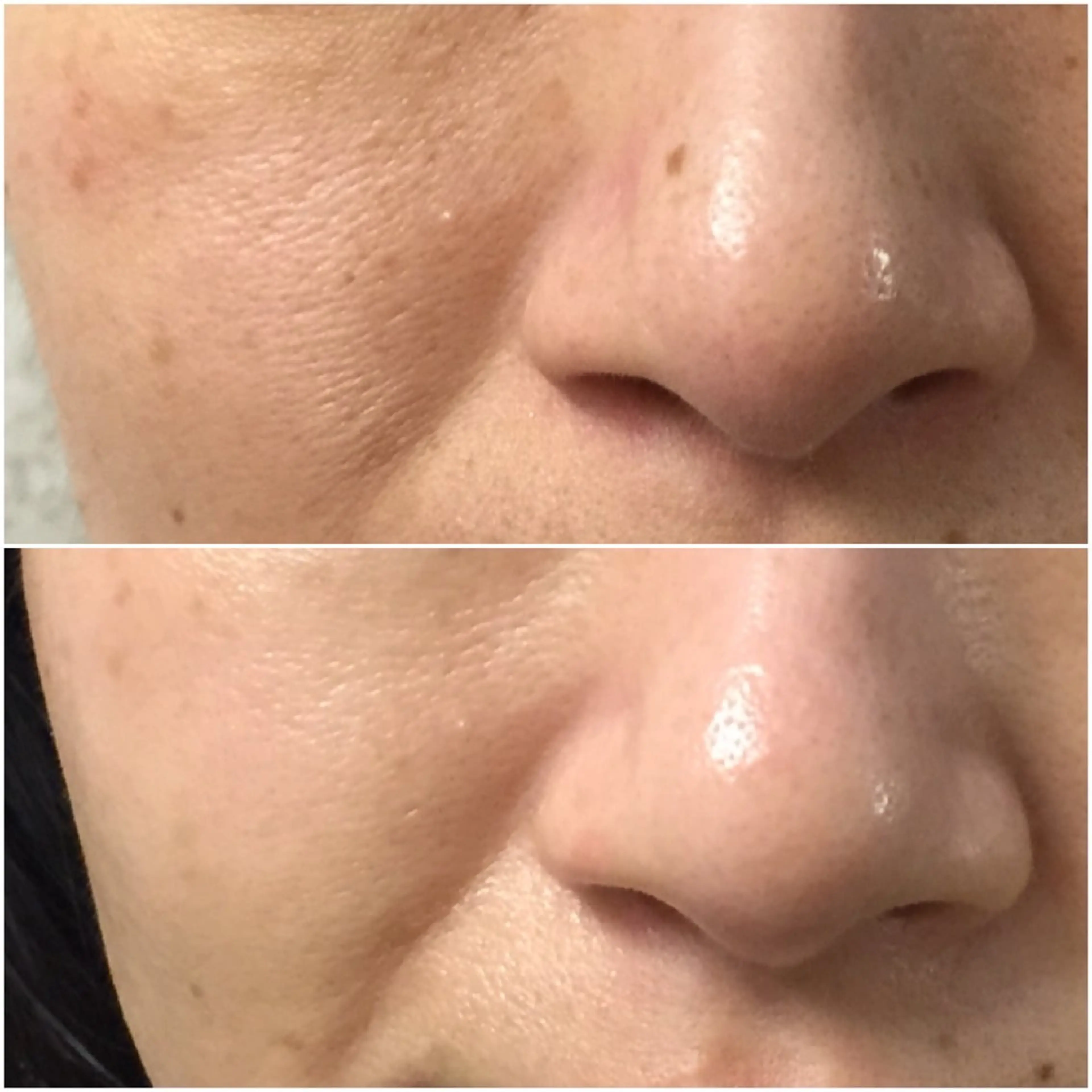 《ハリ不足/たるみケア》エンビロン・エイジングケアコース🍋モニター募集の写真