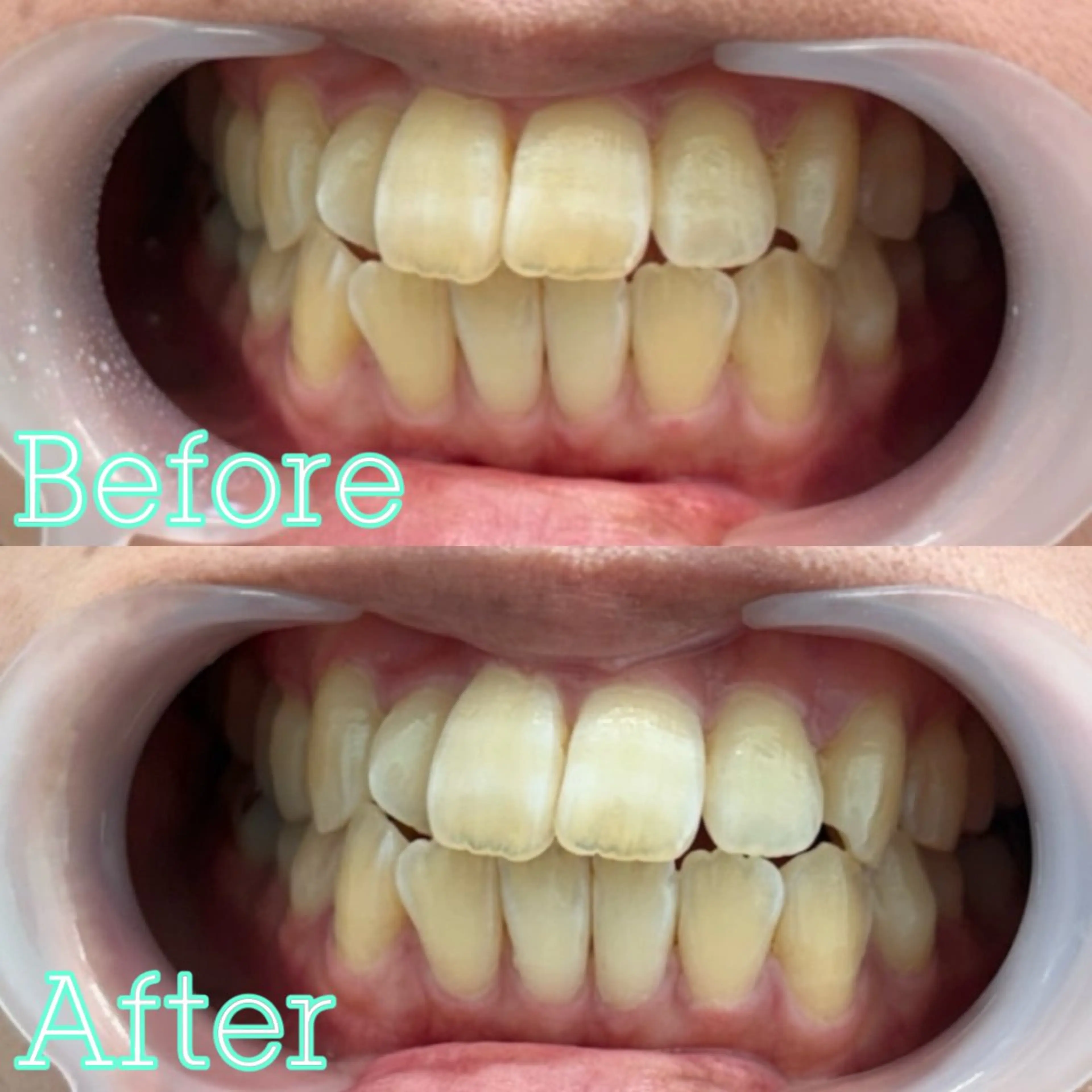 歯のホワイトニング専門店 MIGAQ 京都四条大宮店所属・佐藤 未来の眉毛・アイブロウイメージ