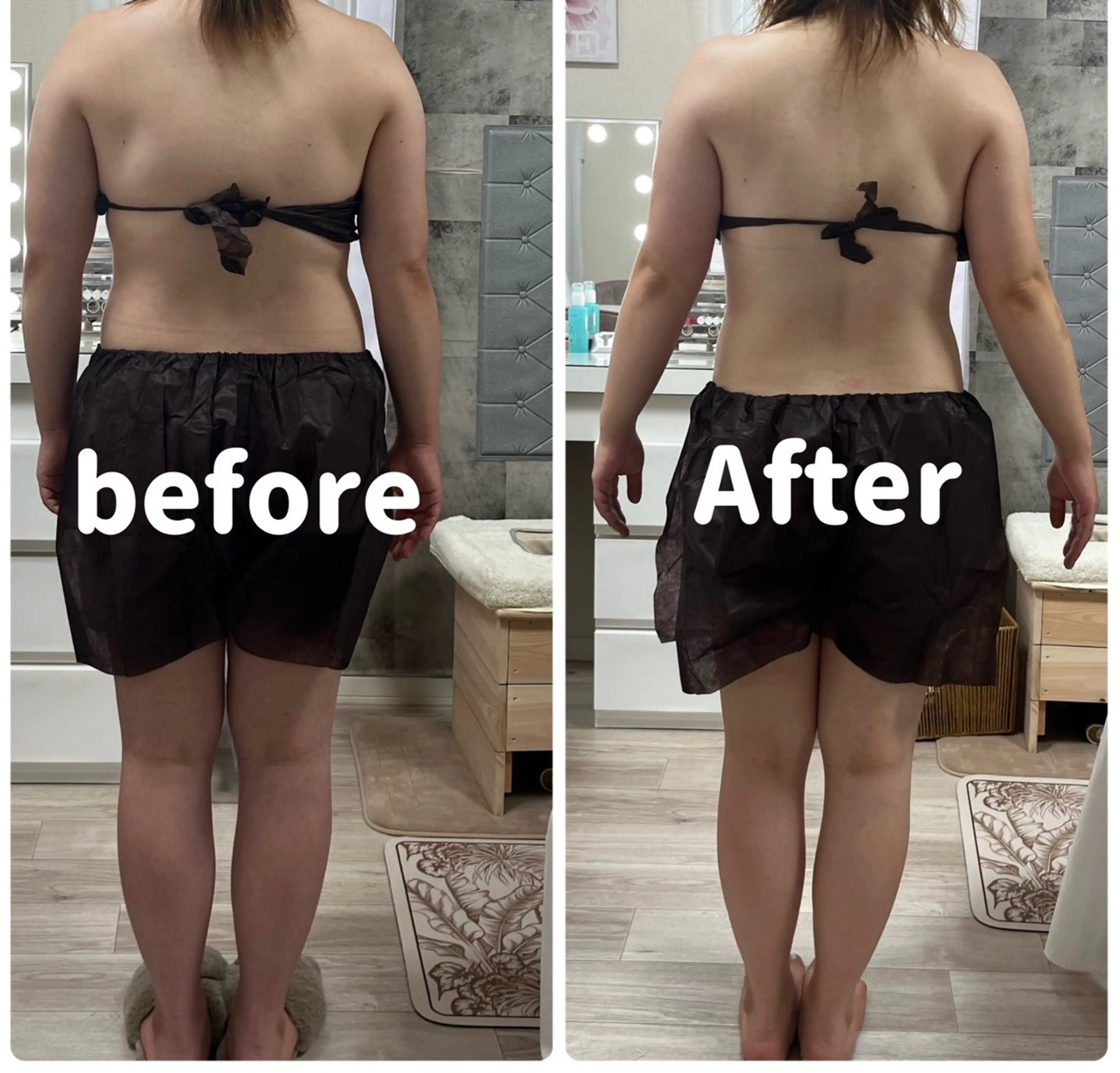 お腹、背中部分やせ可能です✨の写真