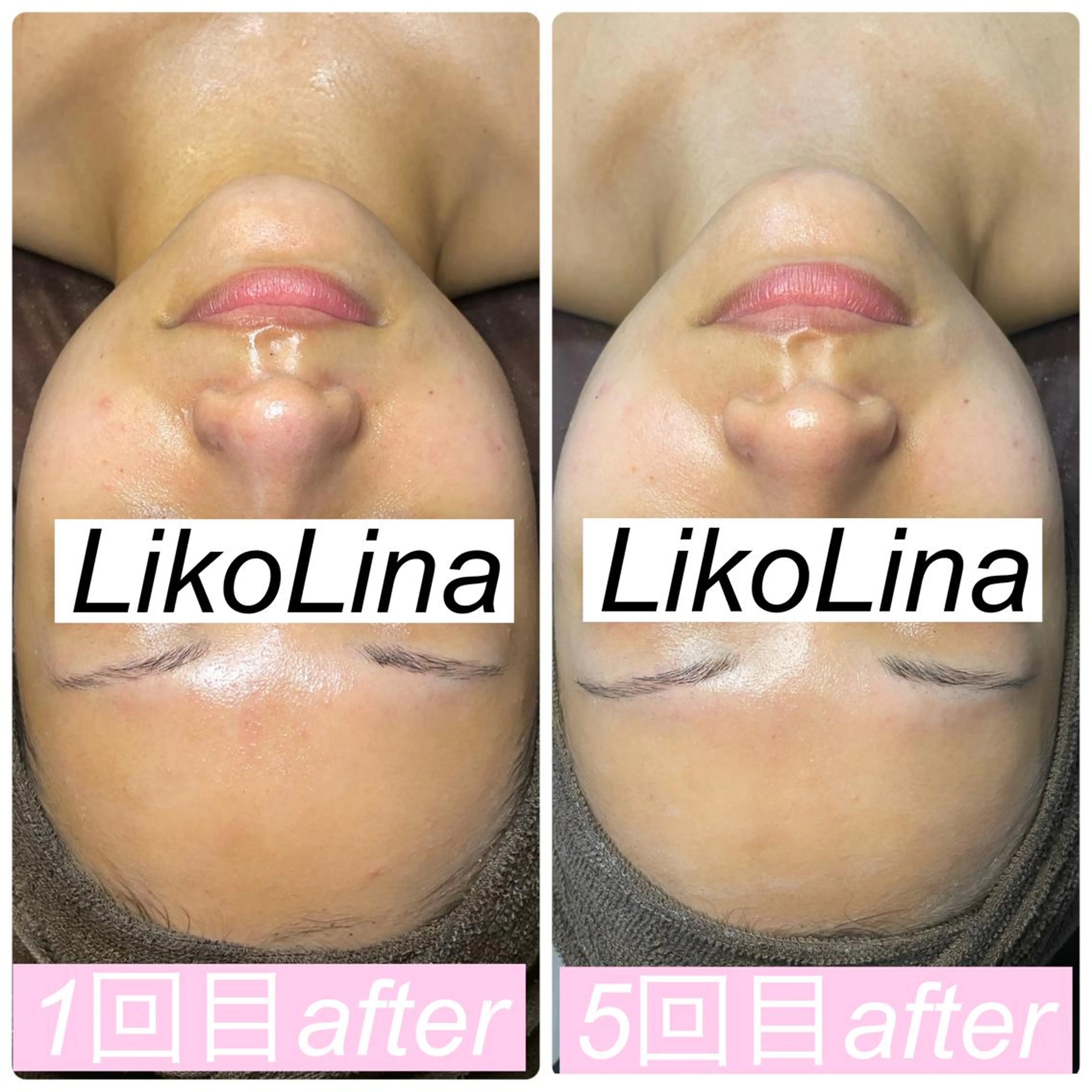 エステ 肌育脱毛サロン LikoLinaのその他イメージ