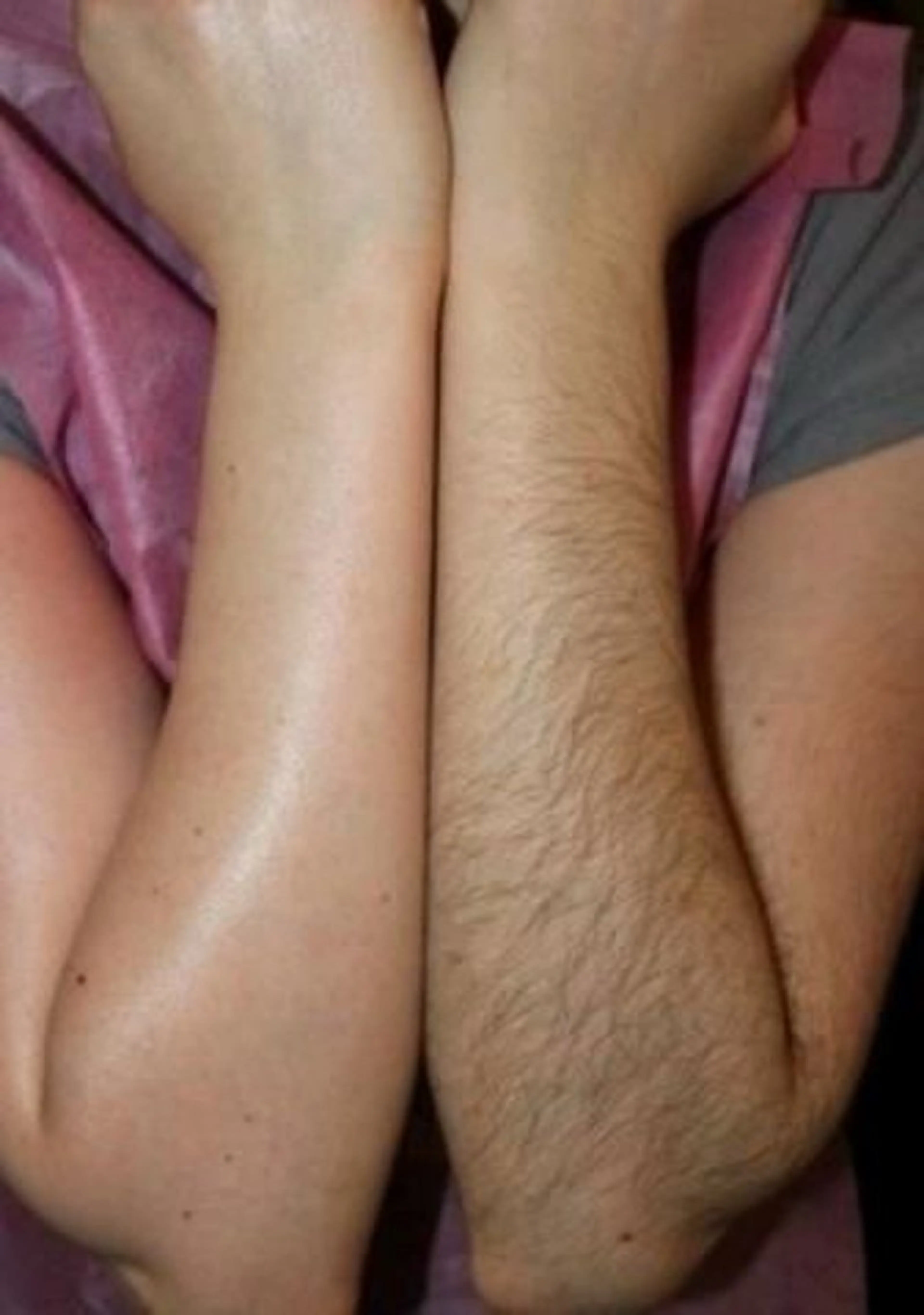 【女性】🍑腕halfワックス脱毛⛱️※ひじを含む上or下の写真