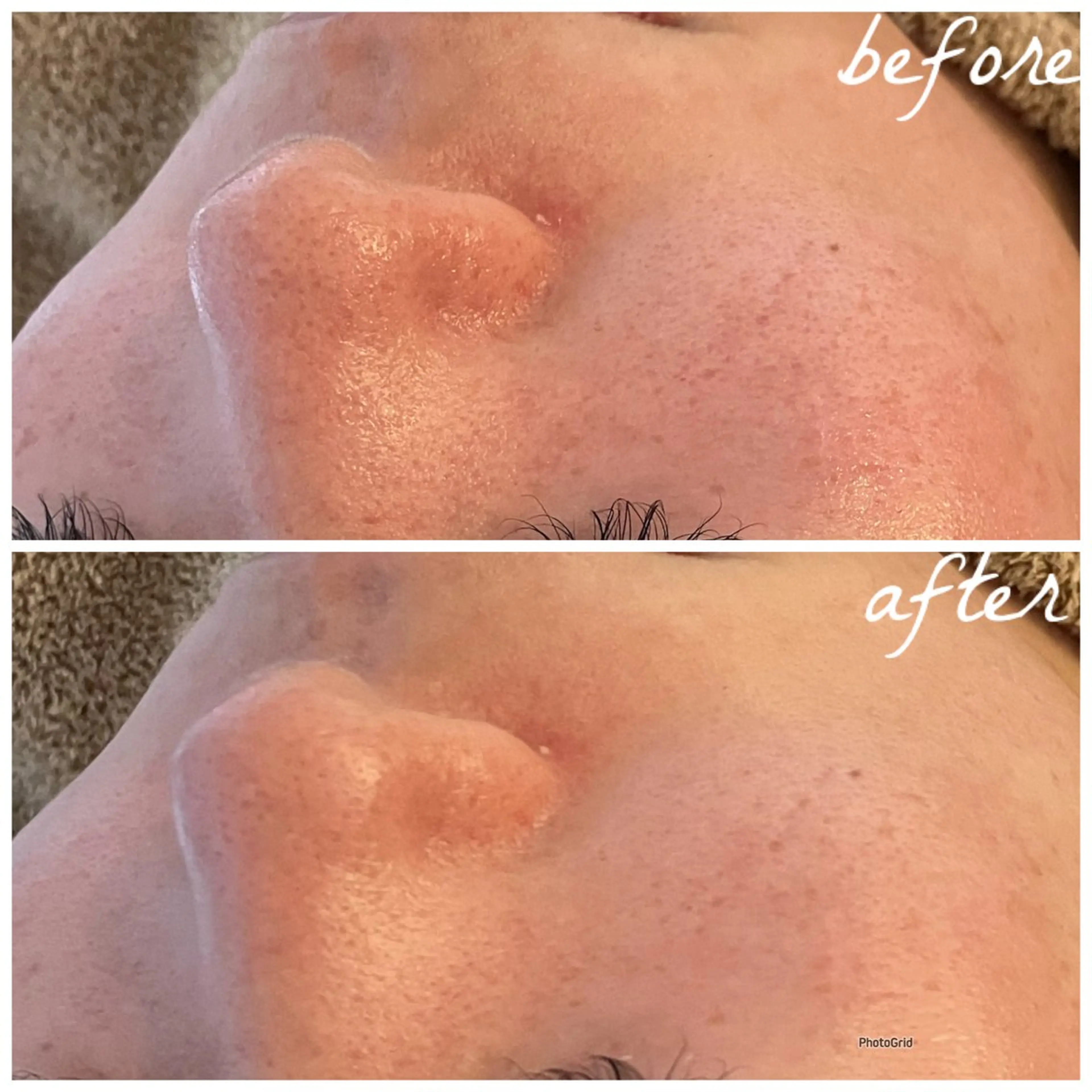 メンズ エステ メナード岐阜茜部 杉浦のエステ・リラクイメージ