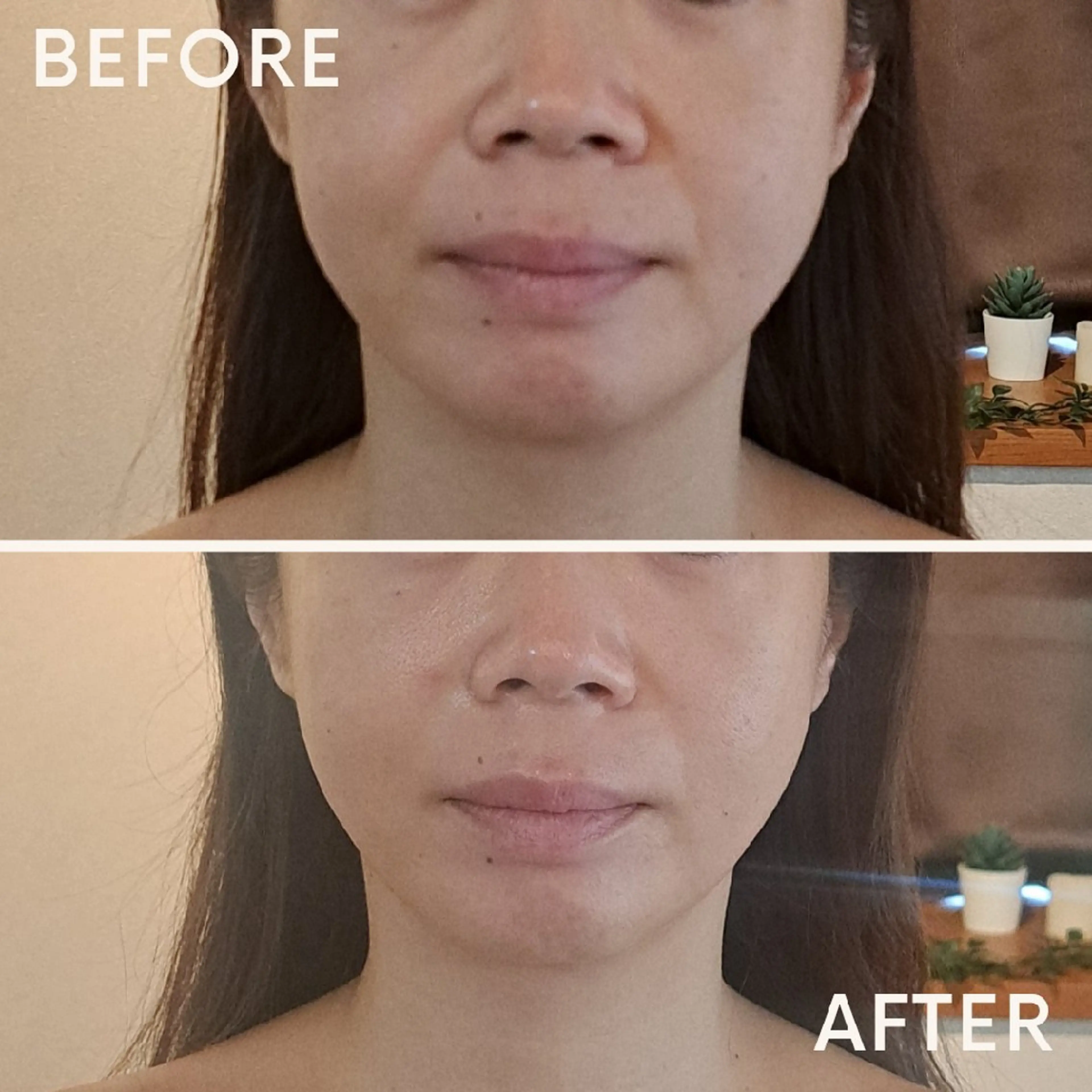 エステ リラク 鍼灸サロンmiyabi所属・美容鍼×エステ　鍼灸 サロンmiyabiのエステ・リラクイメージ