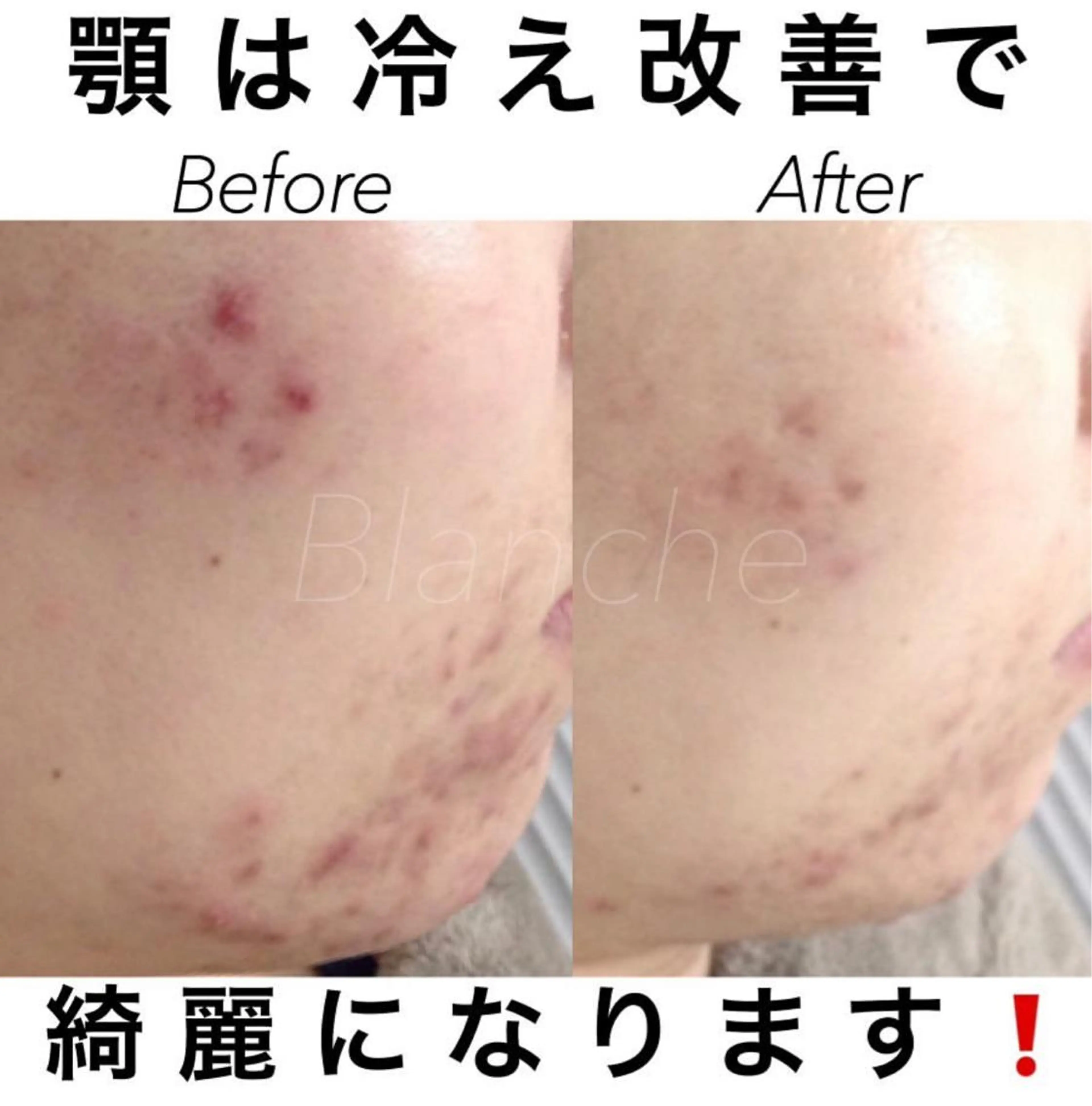 ミディアム カラー パーマ ヘアアレンジ ネイル マツエク・マツパ エステ リラク 都度払い肌質改善 &脱毛Blancheのエステ・リラクイメージ