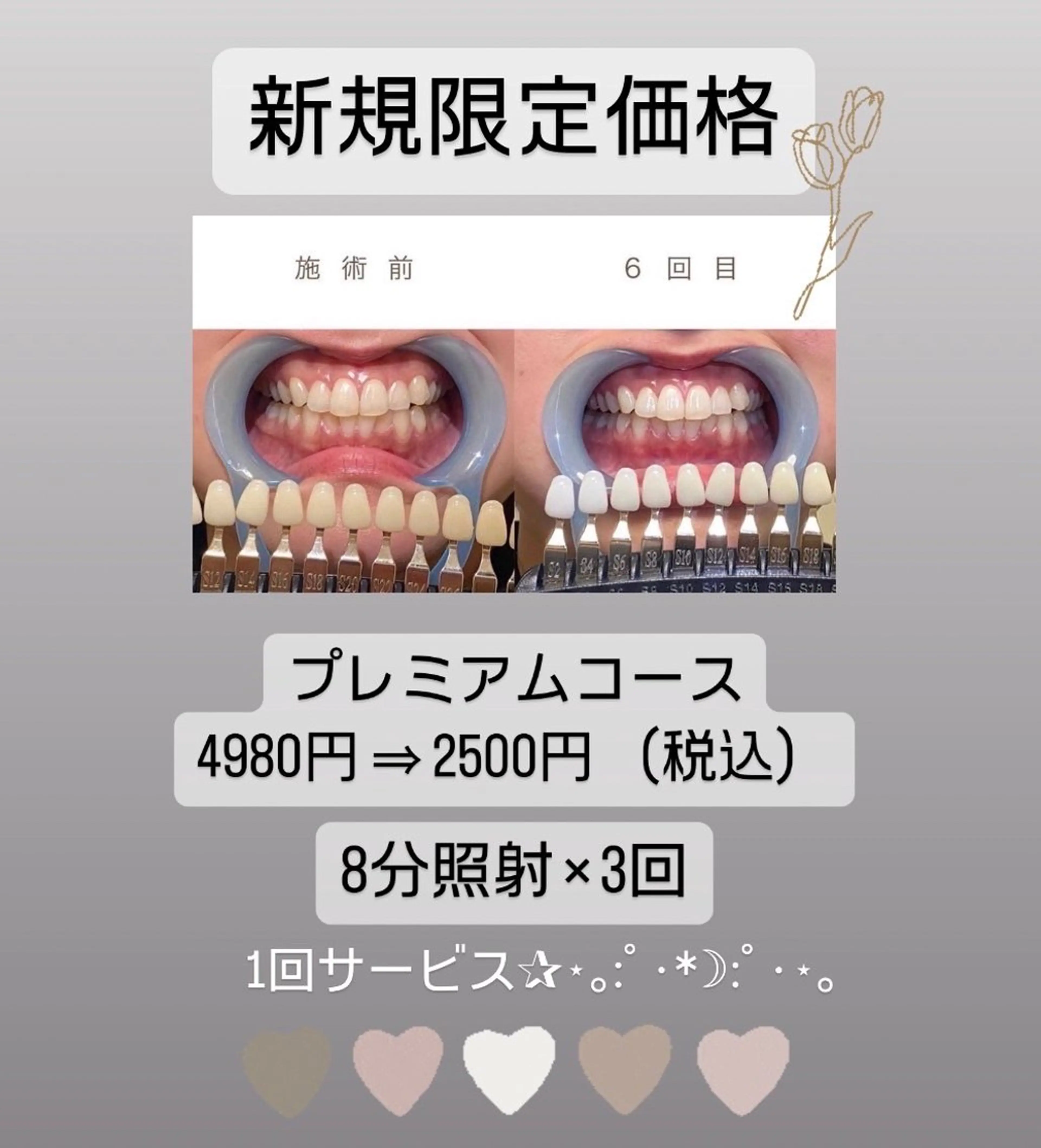 WHITENING ハウスのマツエク・マツパデザイン