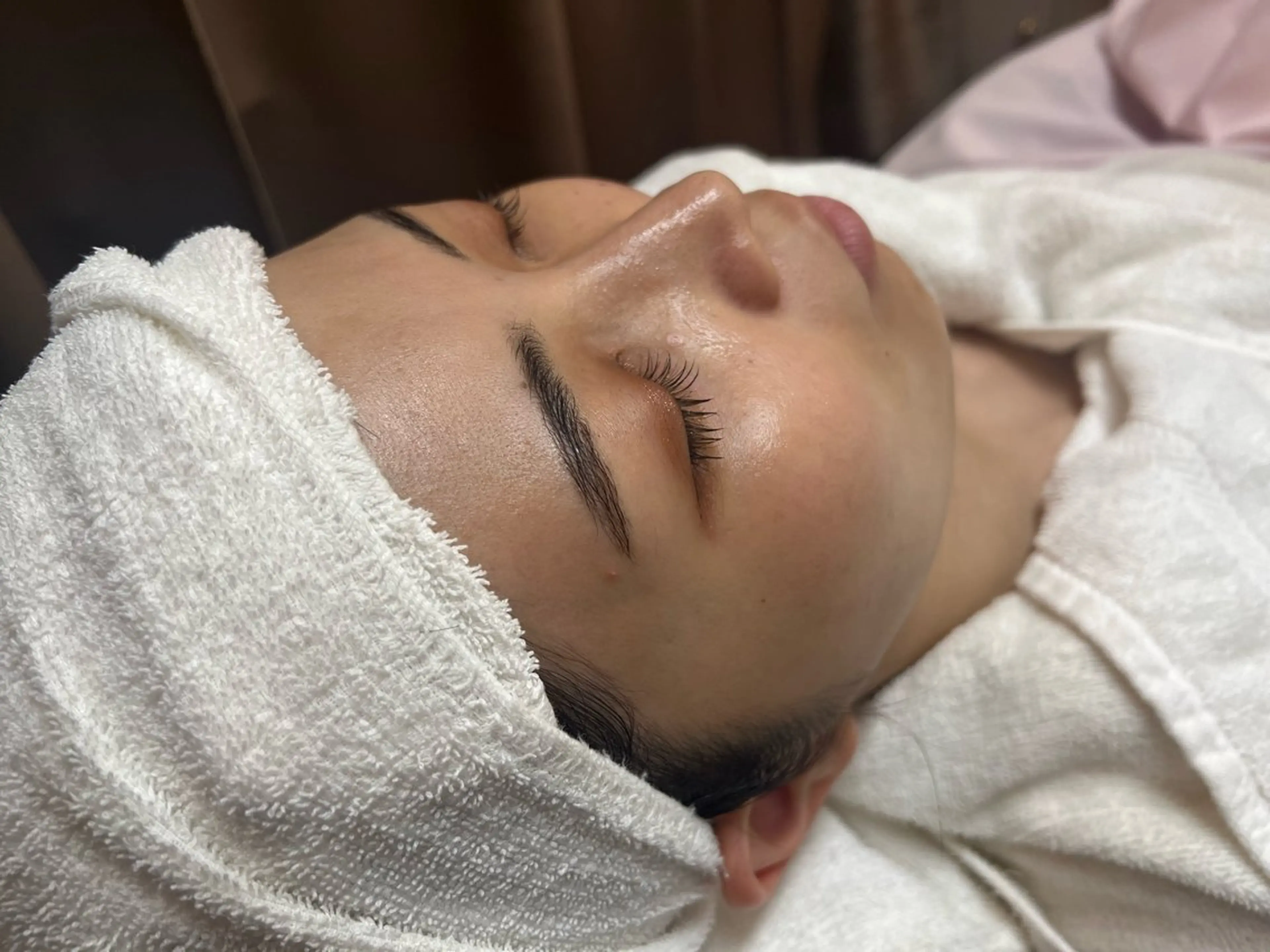 【SNS撮影用】 レディースシェービング(アイブロウ付)＋うなじ✨産毛や角質除去でつるんと陶器肌に✨キメや透明感もUP◎の写真