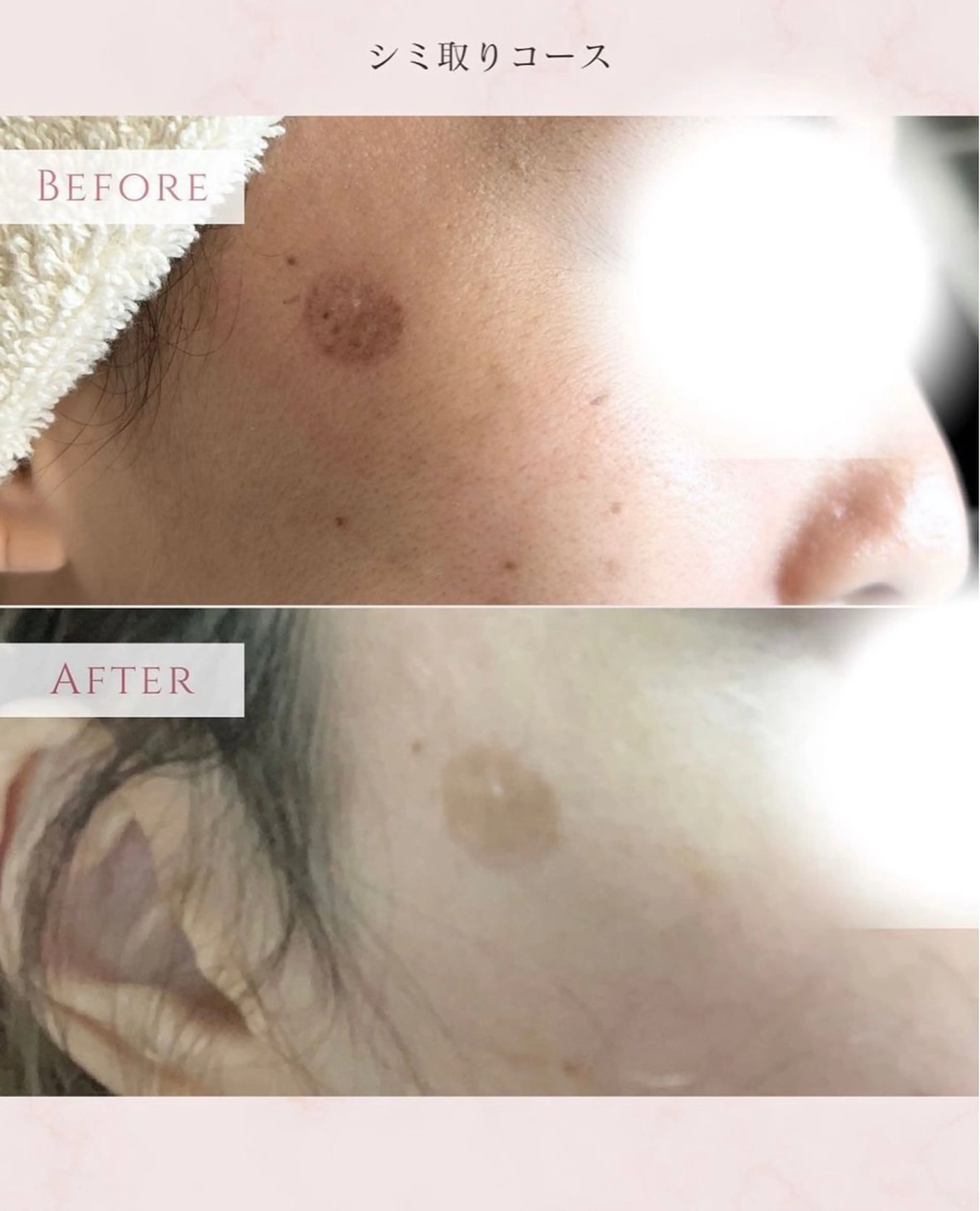 エステ N.style所属・Ｎ. styleのネイルデザイン