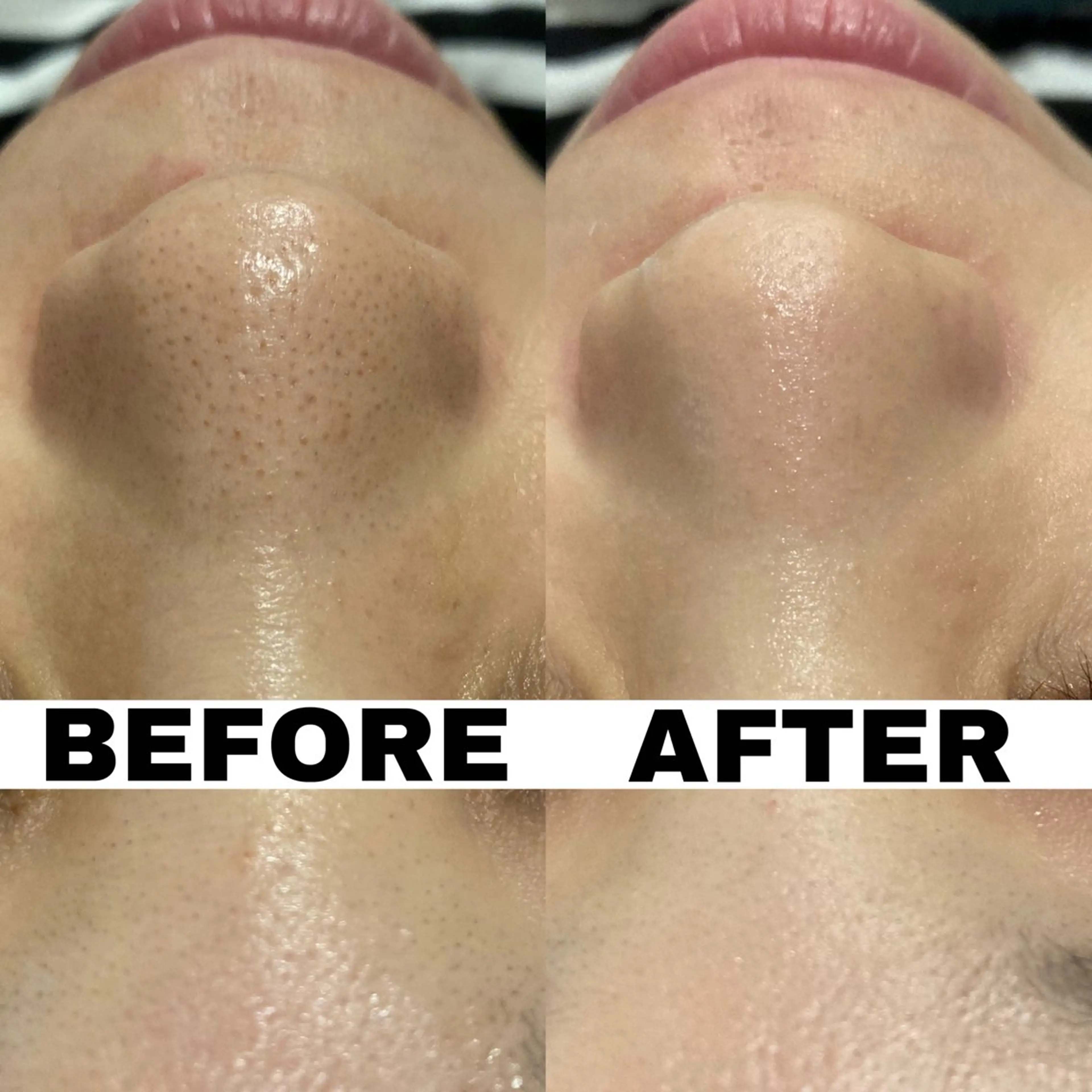 エステ NANI OAFU所属・NANIOAFU [なんば店］のその他イメージ