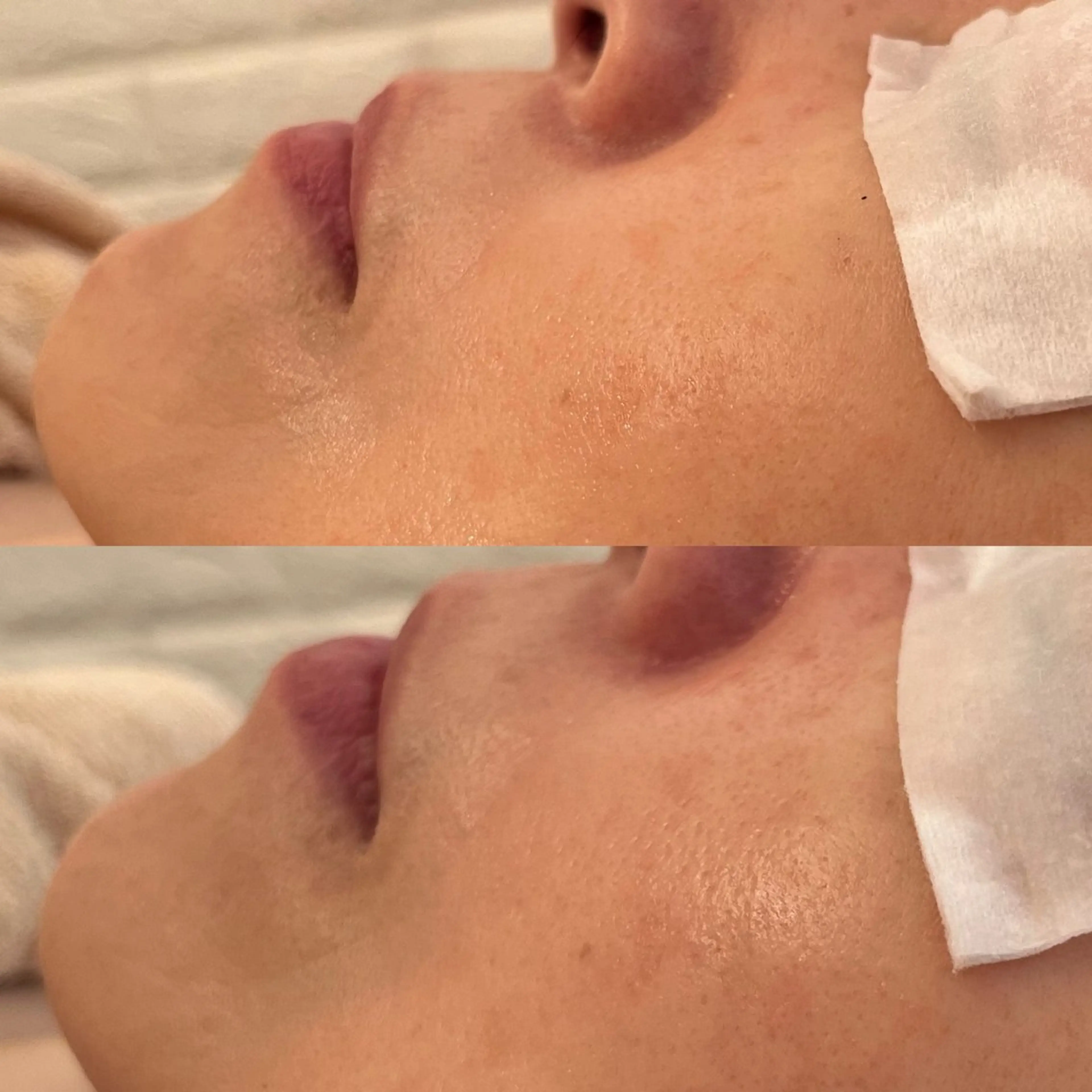 エステ リラク 毛穴ケア/毛穴診断/ 毛穴洗浄〔心斎橋〕のエステ・リラクイメージ