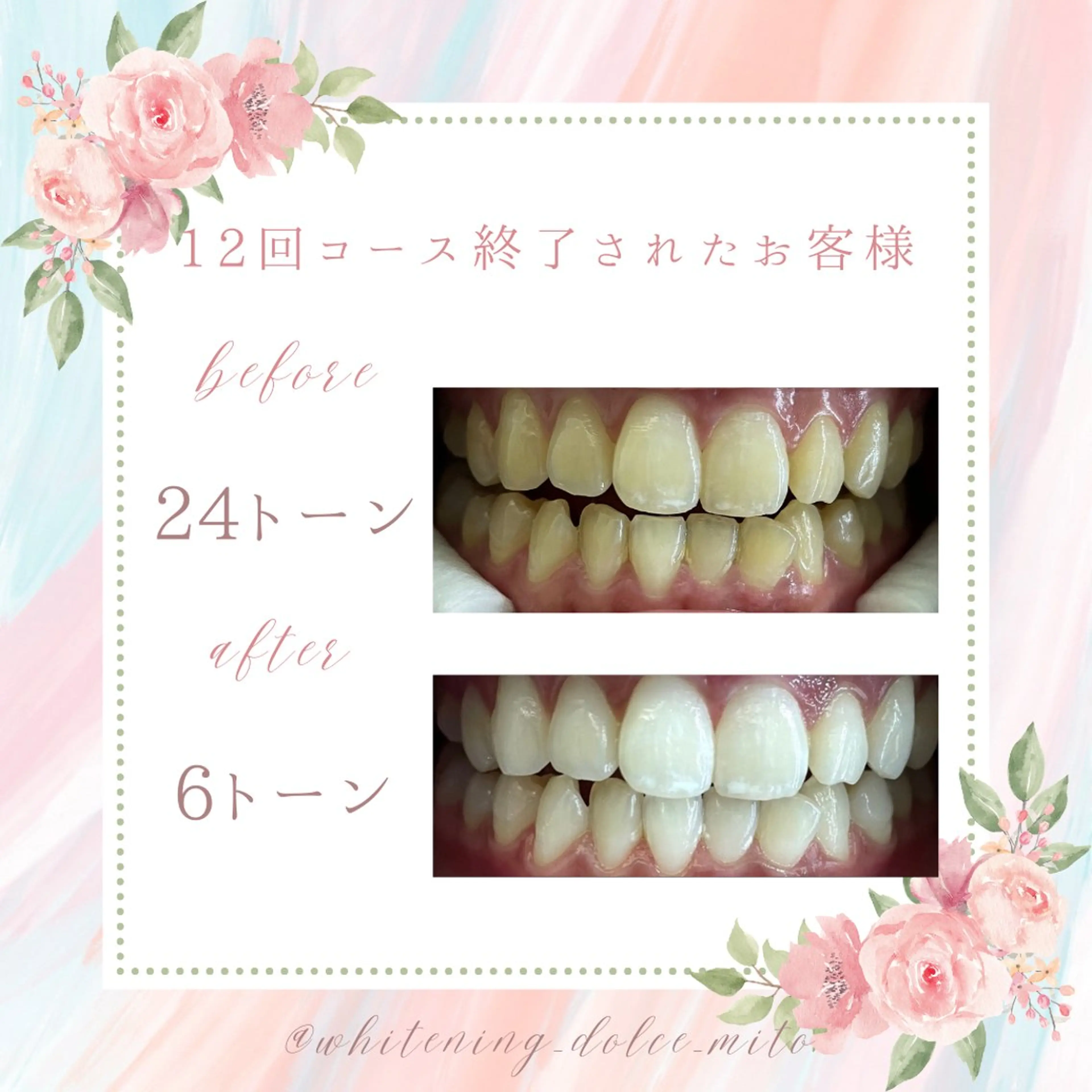 セルフホワイトニング Dolce水戸店のその他イメージ