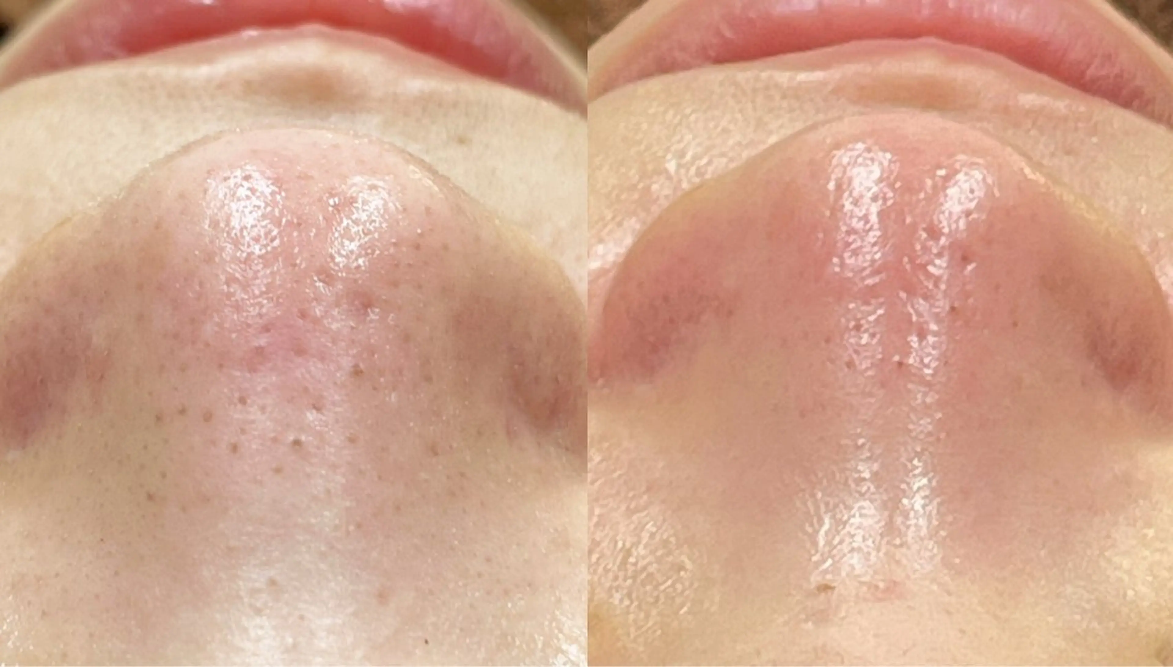 For  Seeds所属・For Seedsのエステ・リラクイメージ