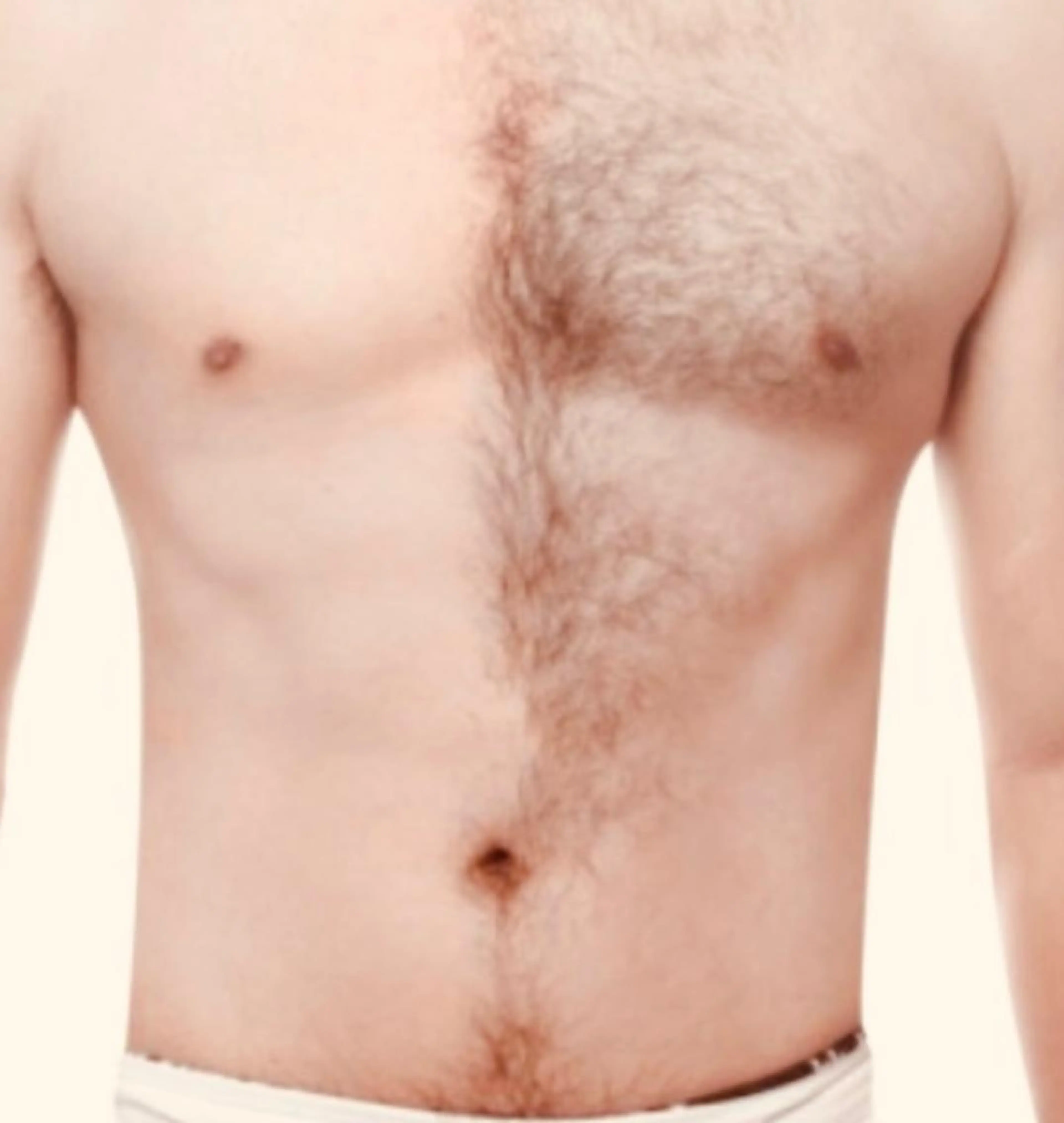 【メンズ脱毛】⭐オーダーメイド脱毛⭐️️SMLパーツから組み合わせ自由⭐️気になる箇所を3箇所選択可❣️脱毛チャンス❣️の写真