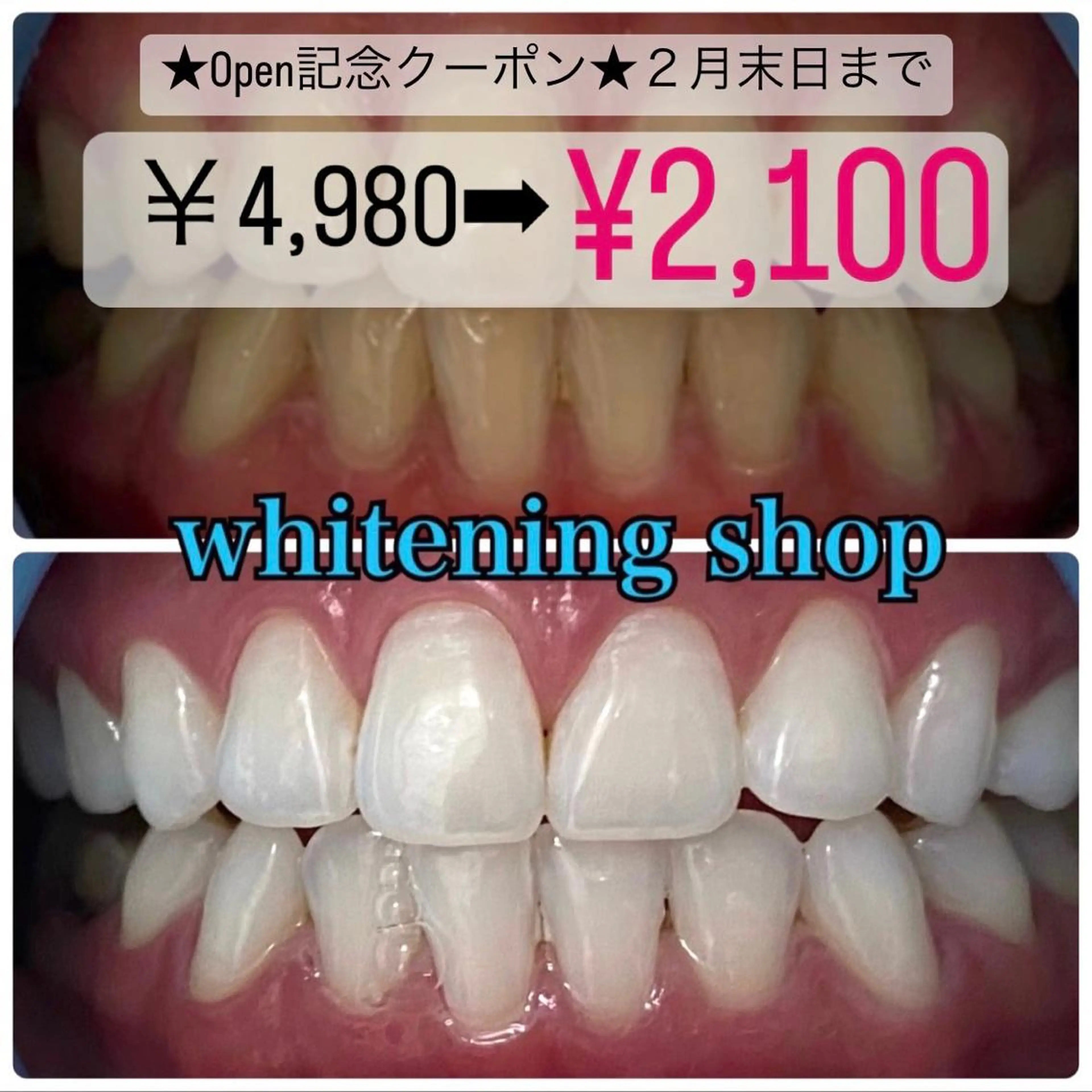 ホワイトニング ショップ千葉店のその他イメージ