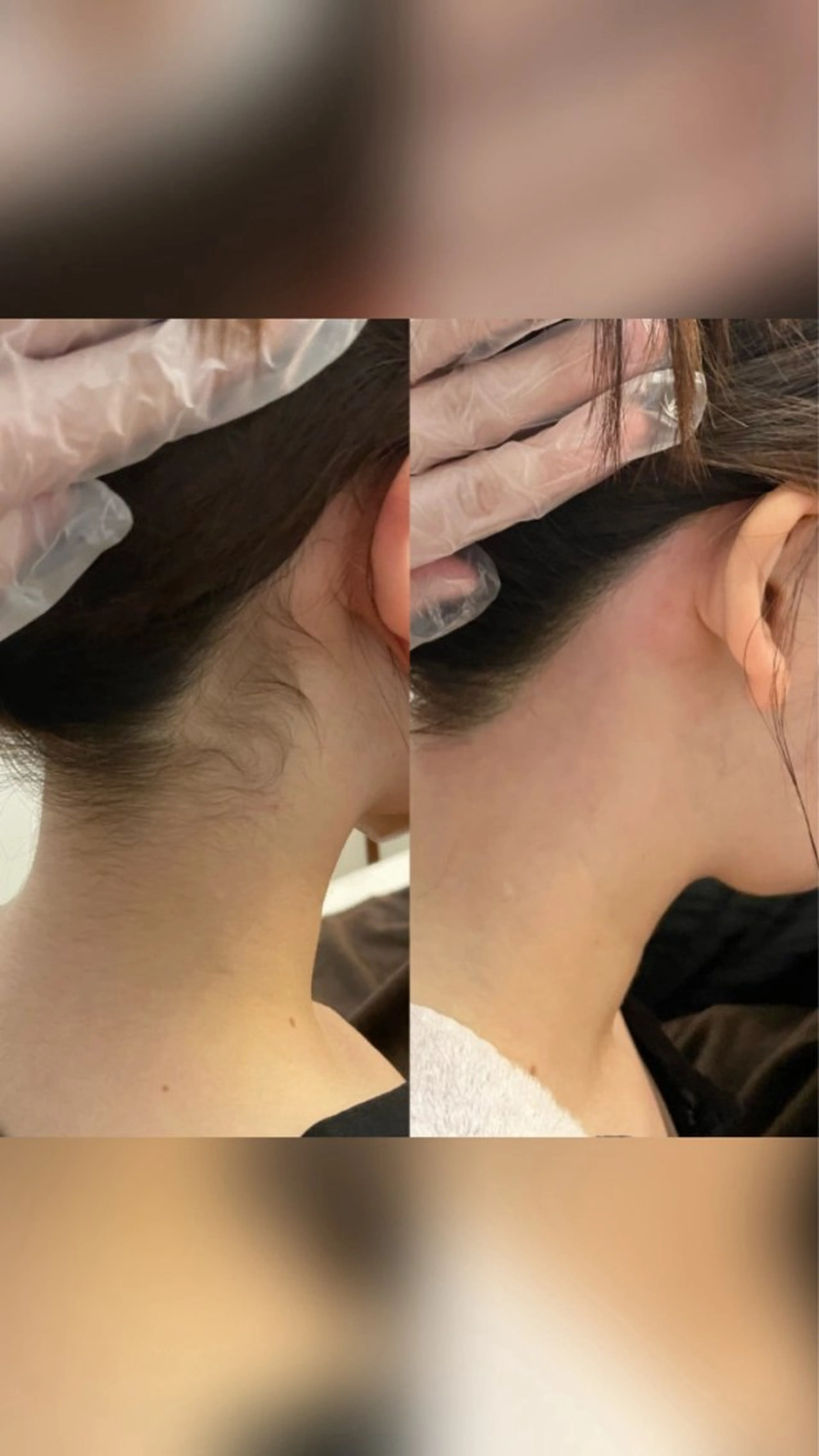 脱毛 宮崎 みおのエステ・リラクイメージ