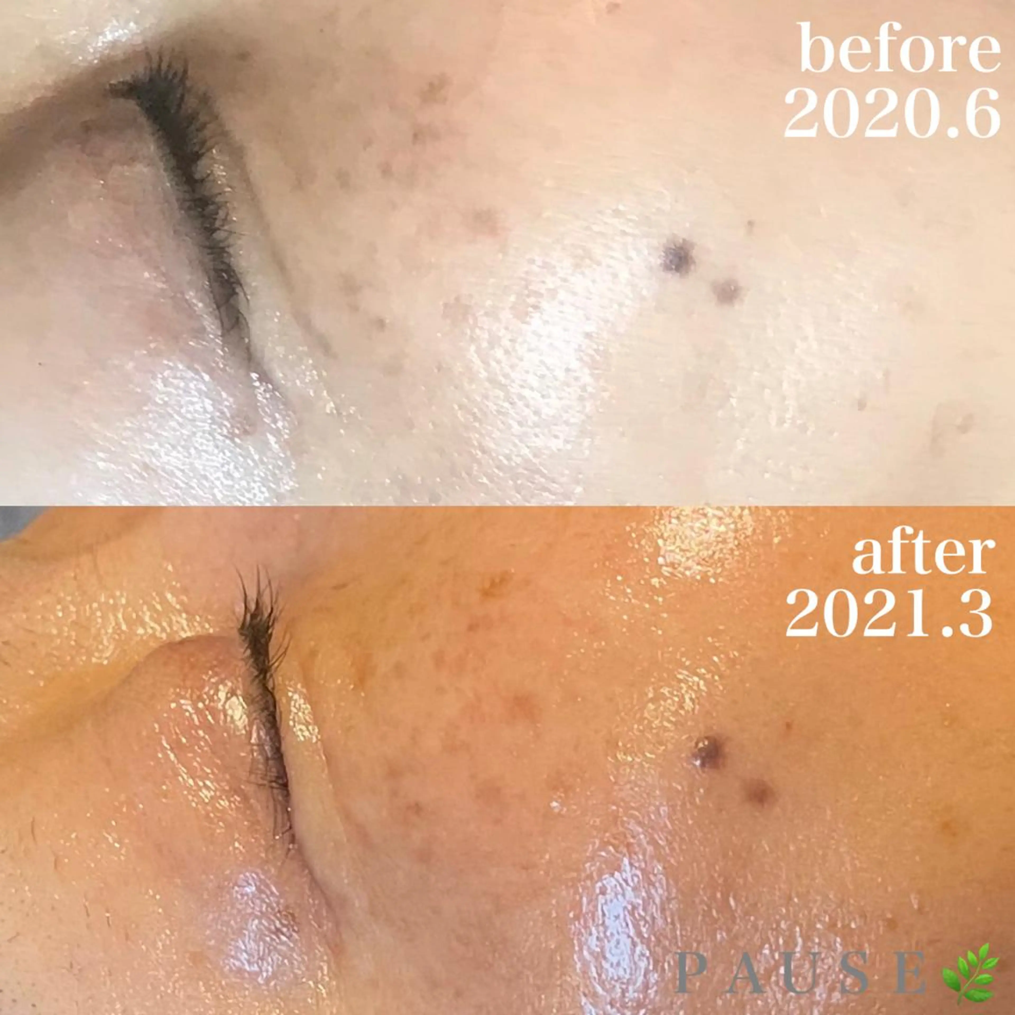 エステ 浜野 恵美のエステ・リラクイメージ