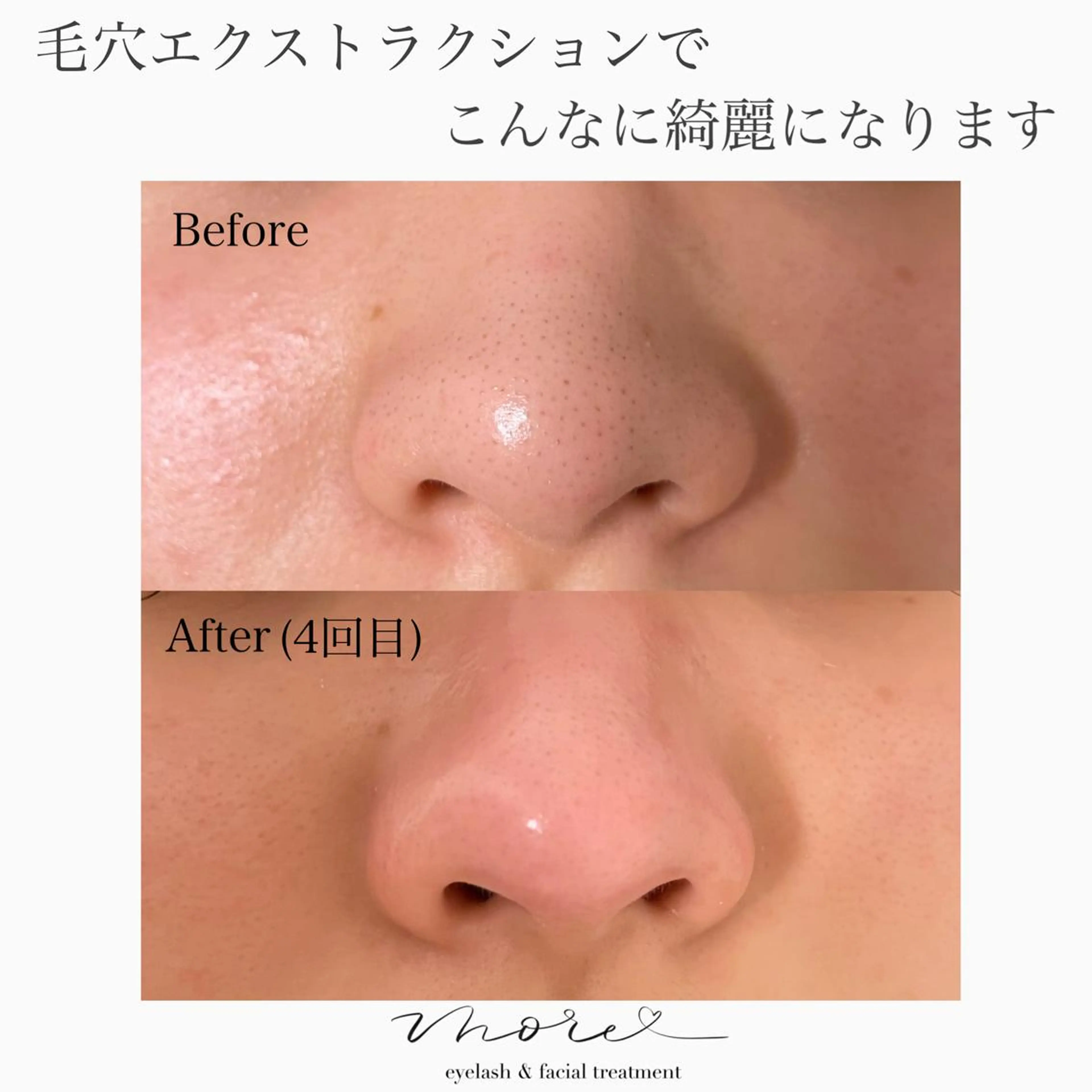 Eyelash salon MORE(モア)所属・安納 麻穂のエステ・リラクイメージ