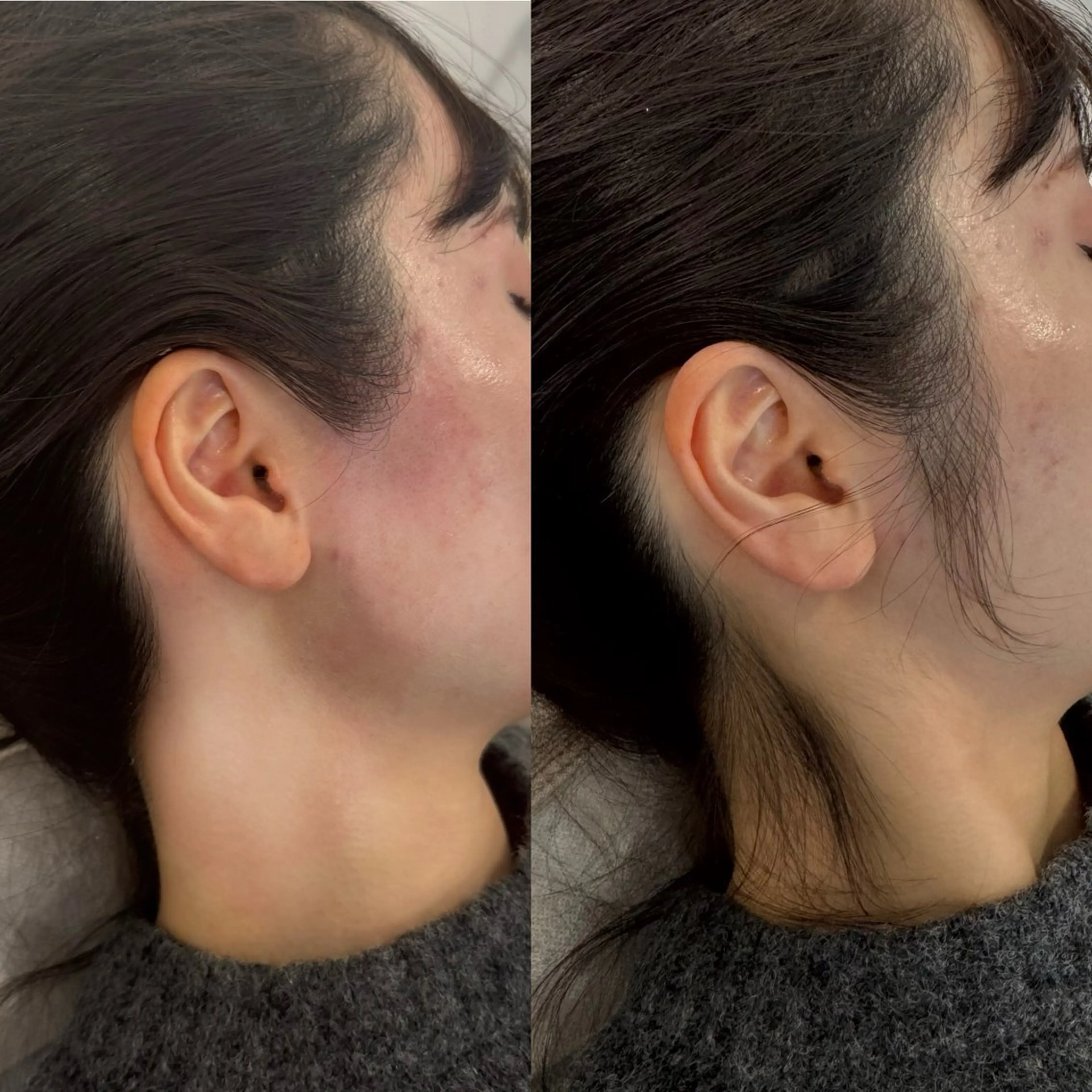 お着物set👘💕うなじ✨もみあげ✨Wax脱毛🎁の写真