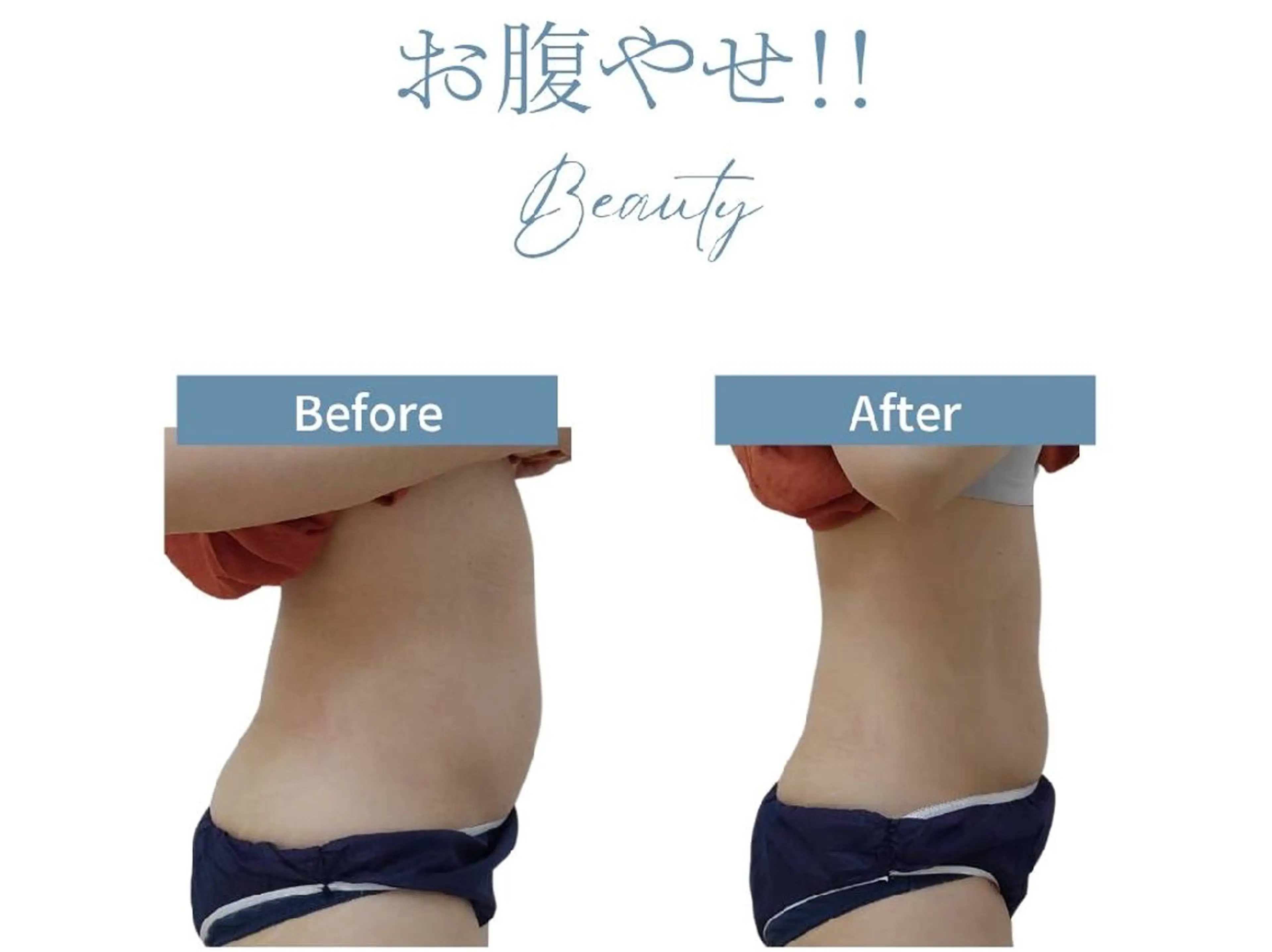 短期集中コース体験◆上半身痩身（お腹・背中・二の腕）の写真