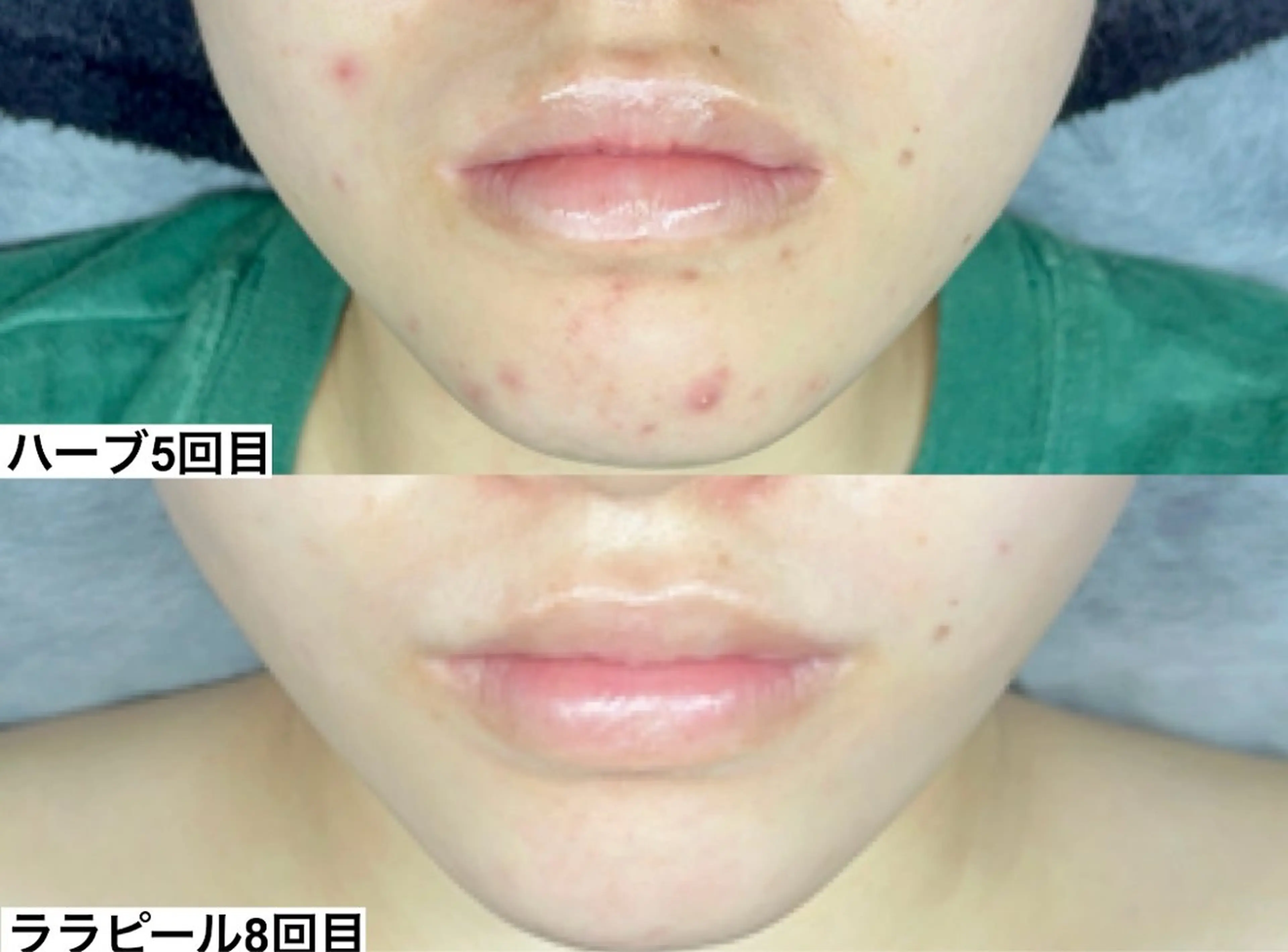 ピーリング×韓国肌管理【&me神戸元町店】所属・ピーリング×肌質管理 &meのエステ・リラクイメージ