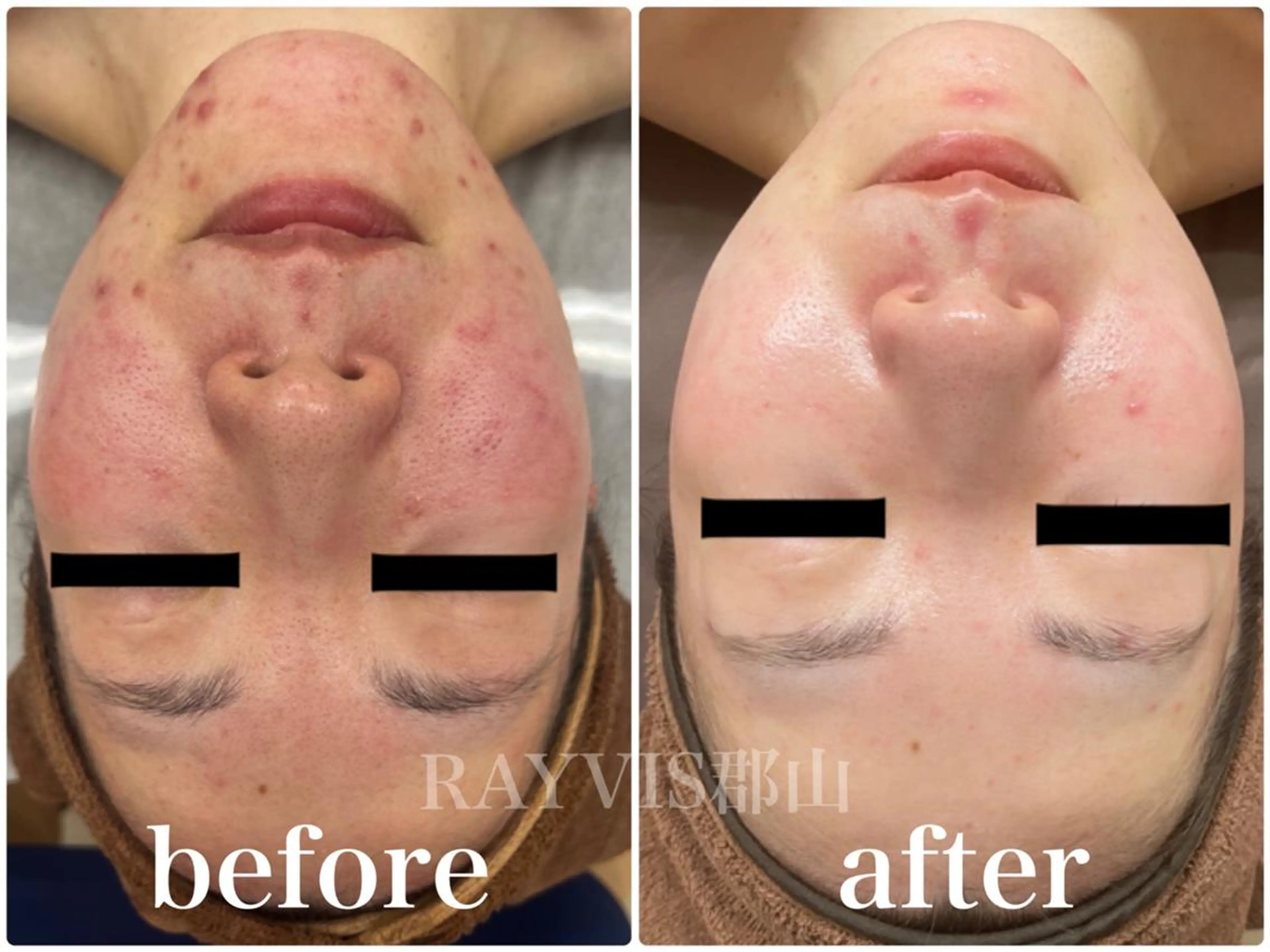 🩵RAYVIS🩵 郡山店のエステ・リラクイメージ