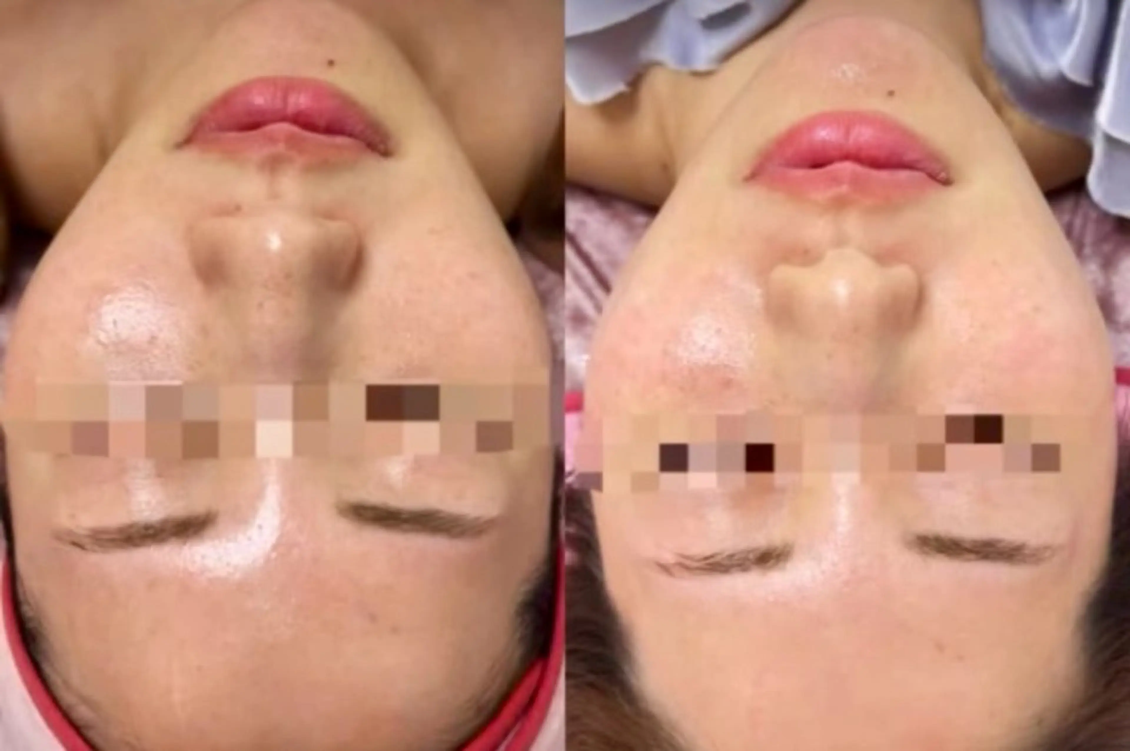 最新✨高周波美容【即効小顔】DTなしの感動を◎💆‍♀️の写真