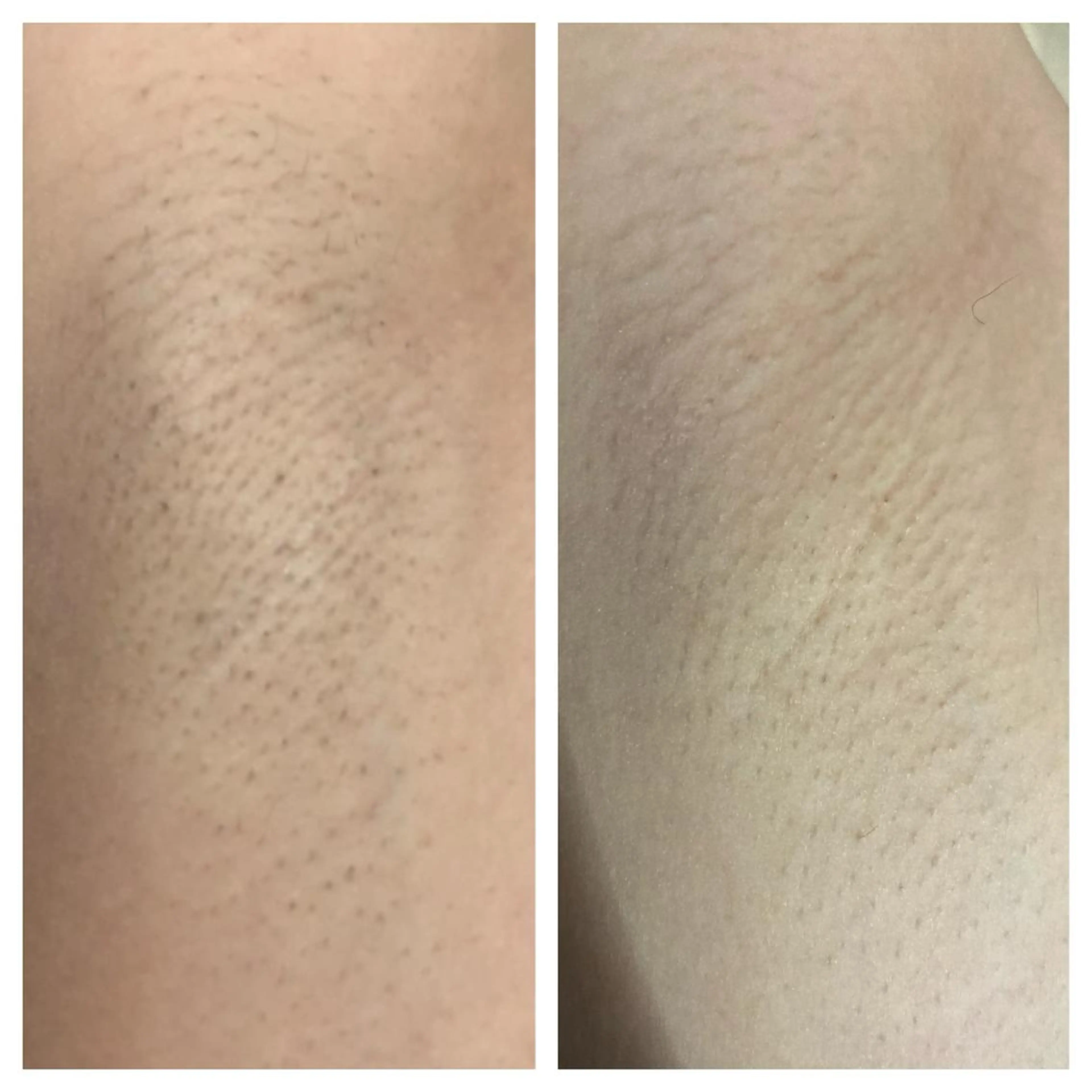 Alice城山台店所属・Alice 城山台店のエステ・リラクイメージ