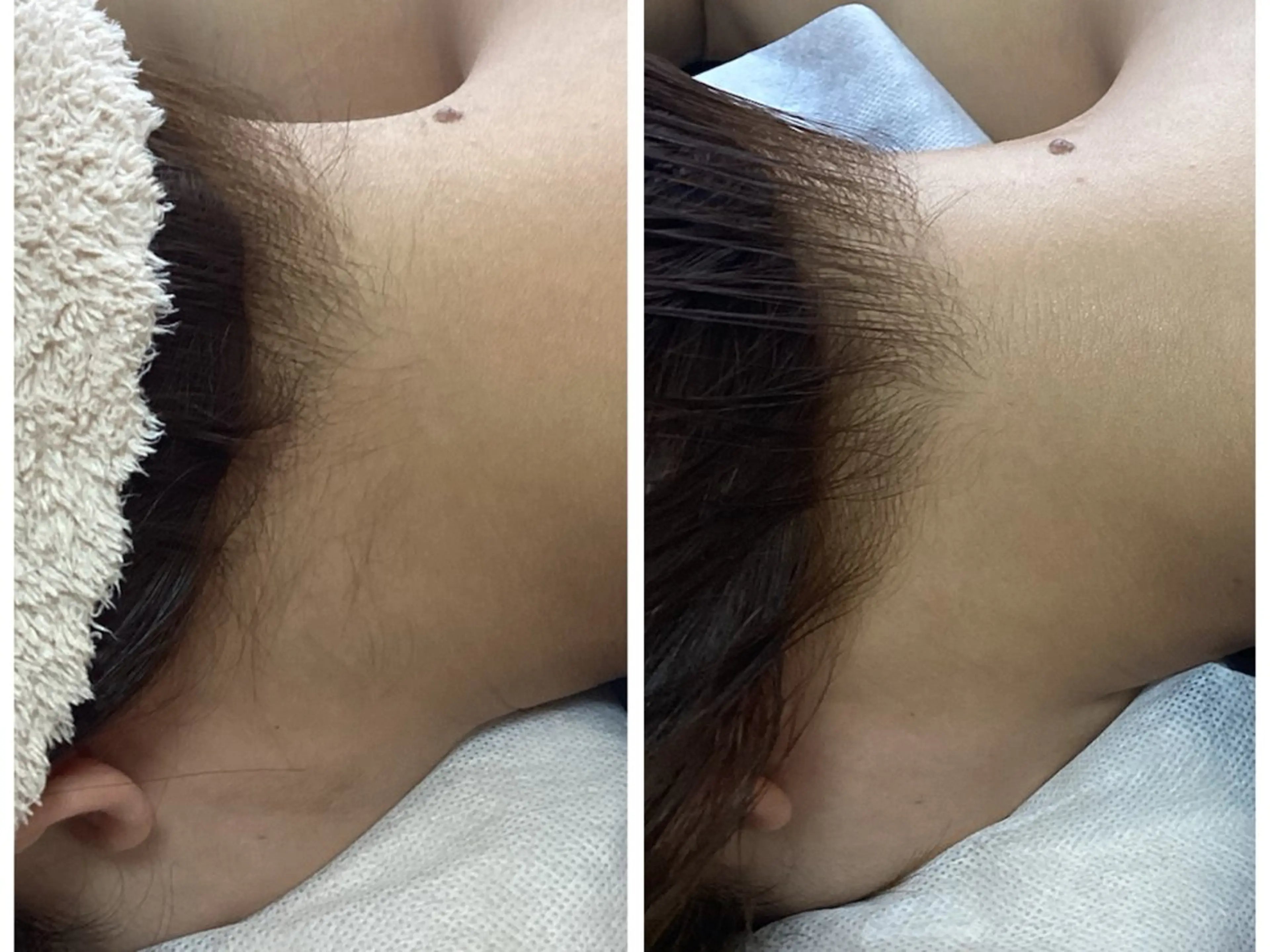 脱毛 脱毛専門減毛サロン LULU.tokyoのエステ・リラクイメージ