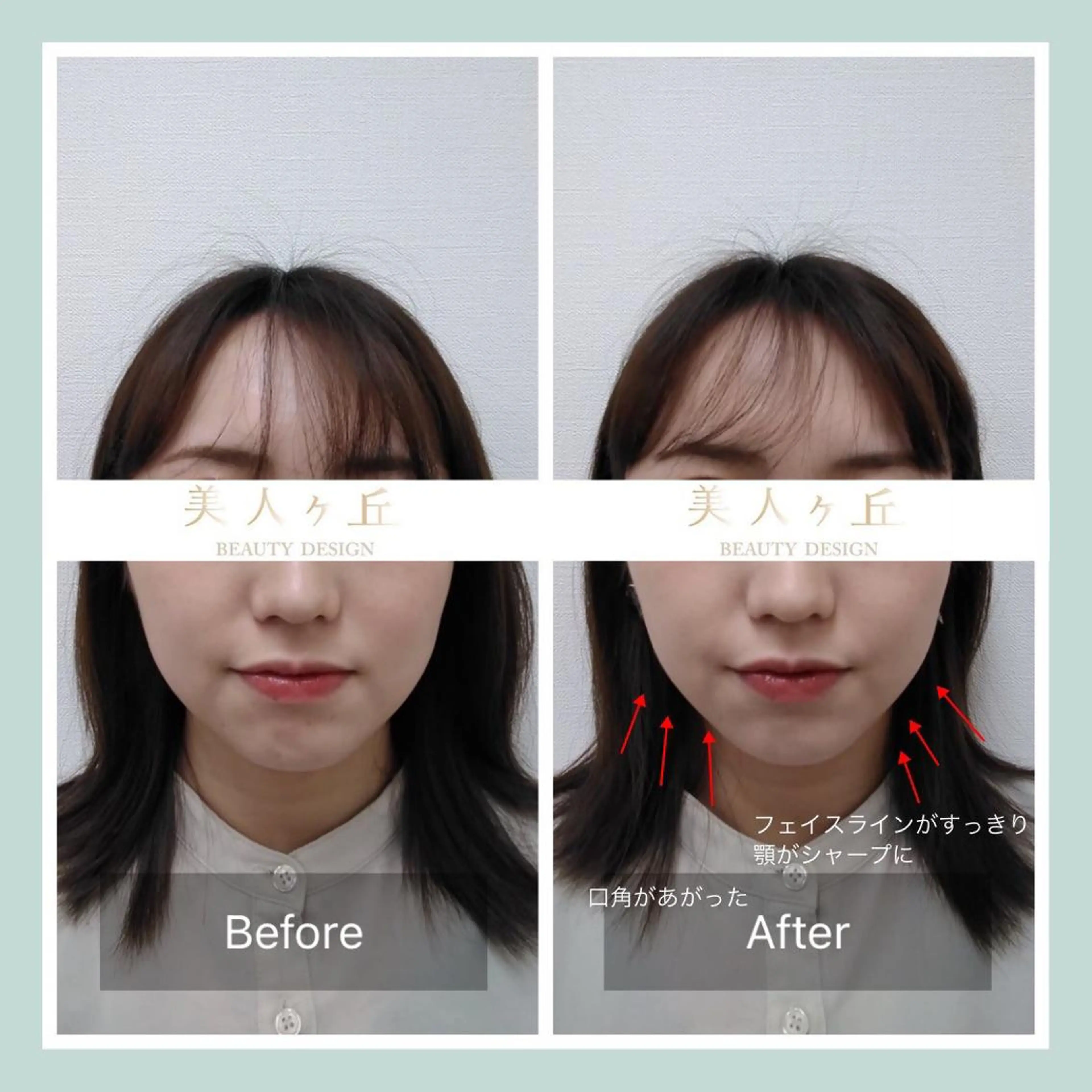 《🇰🇷韓国コルギより効果実感！？》歪みを整え大胆リフトアップ‼︎ 黄金比率を造る💎造顔小顔矯正2SET30分🌈の写真