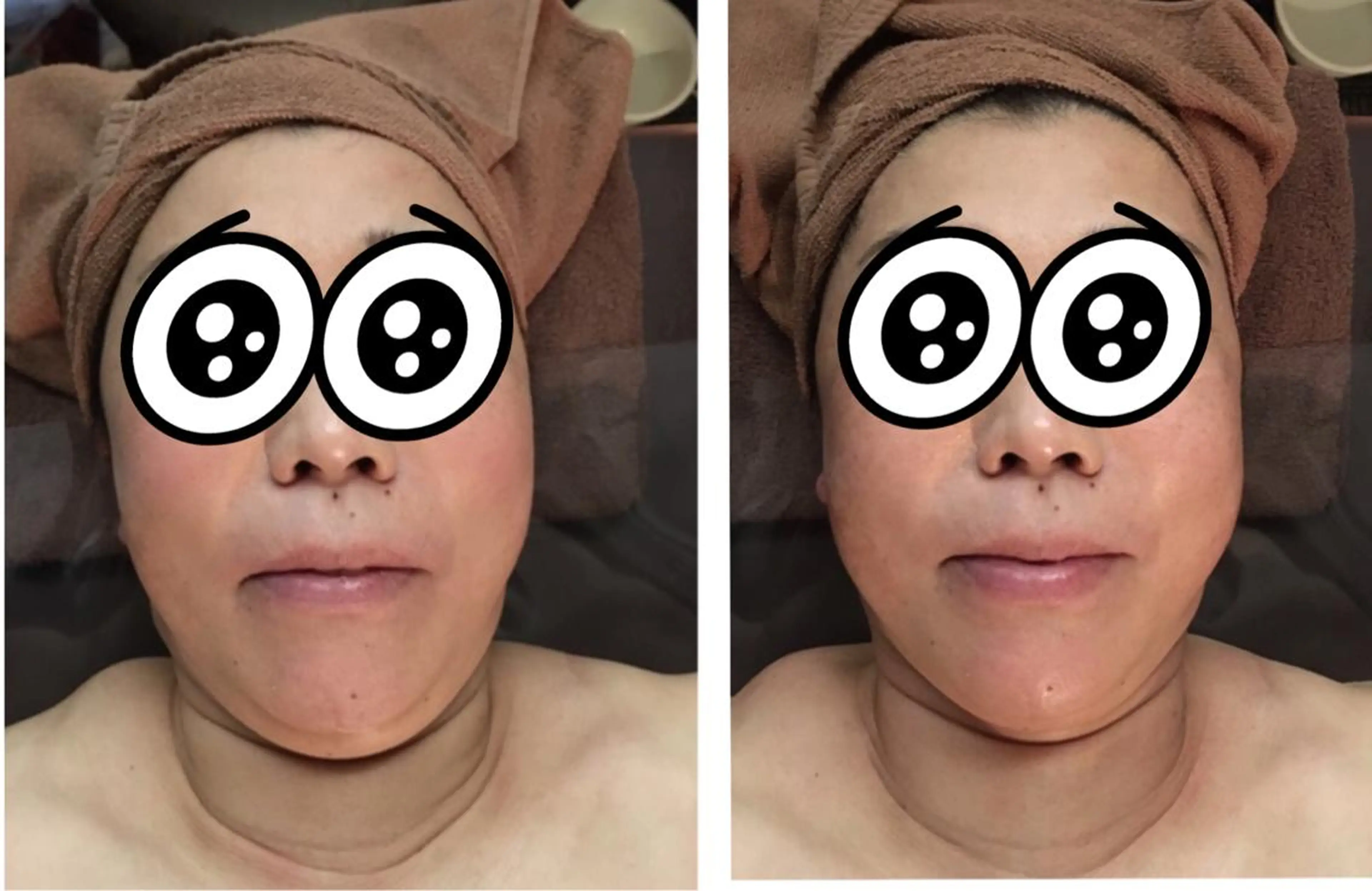 速攻小顔フェイシャルの写真