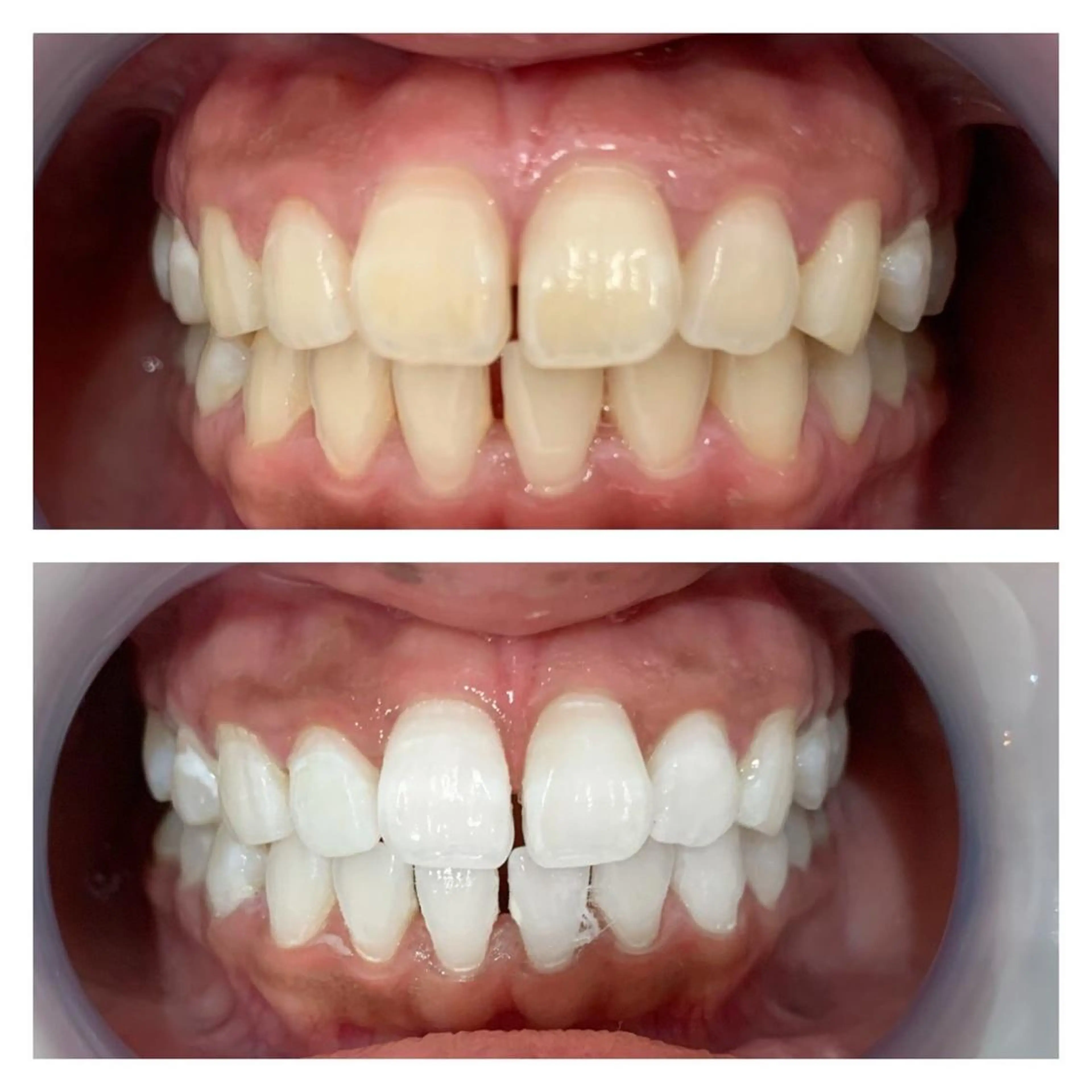 Monreve所属・美人スイッチdiet スーパージェクションのその他イメージ