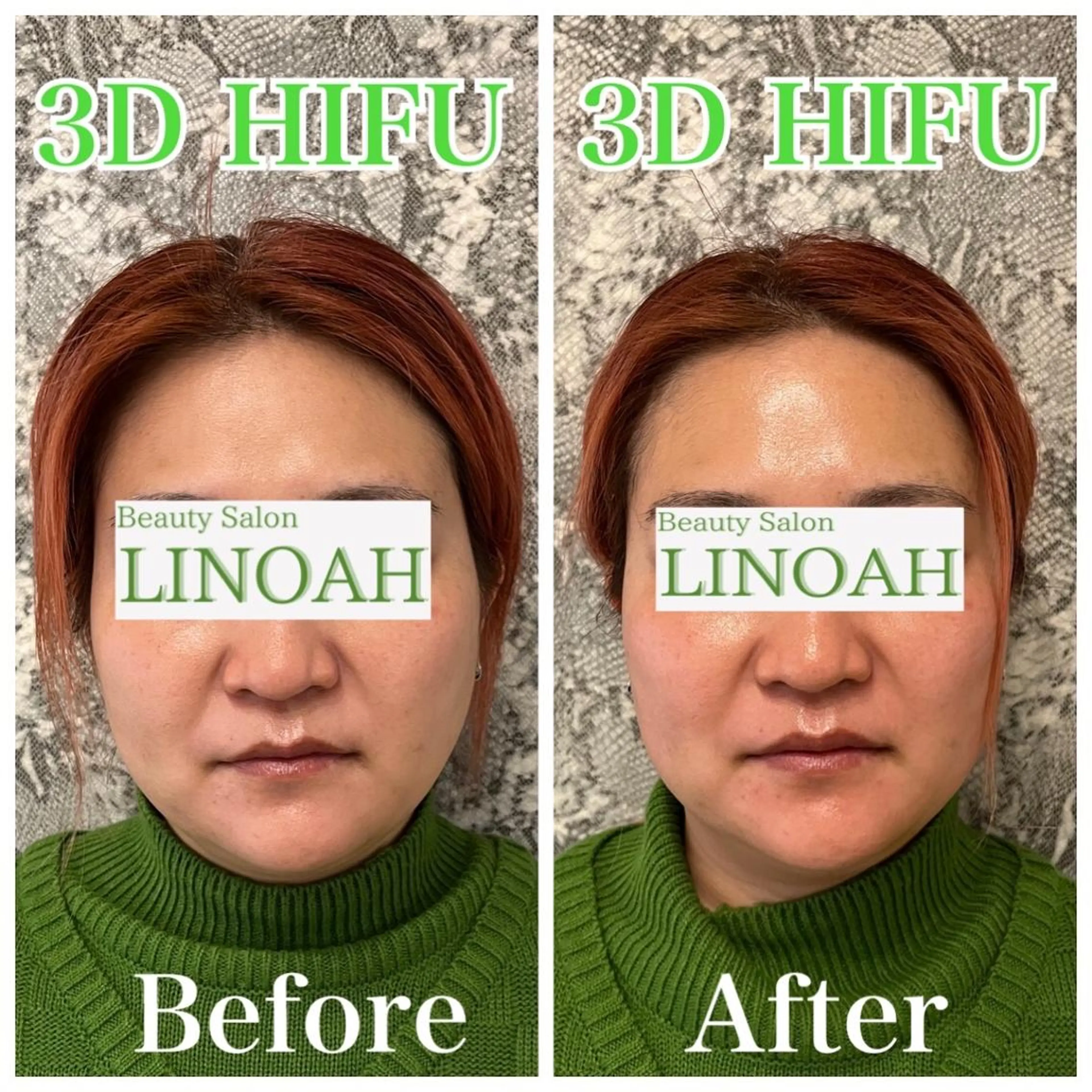 パーマ マツエク・マツパ アイブロウ メンズ エステ リラク ビューティーサロン リノアのエステ・リラクイメージ