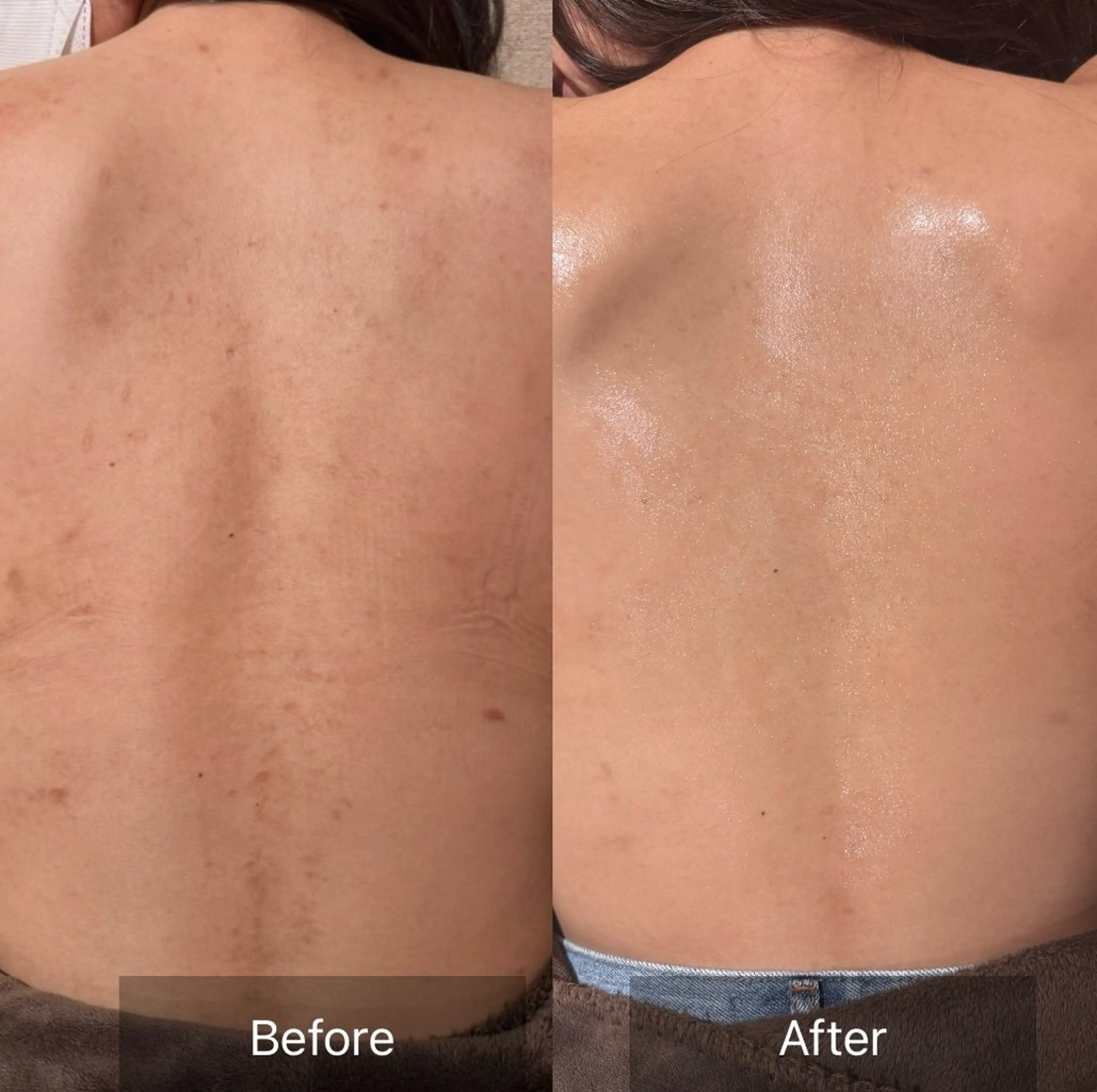 その他 for woman所属・森 美優のエステ・リラクイメージ