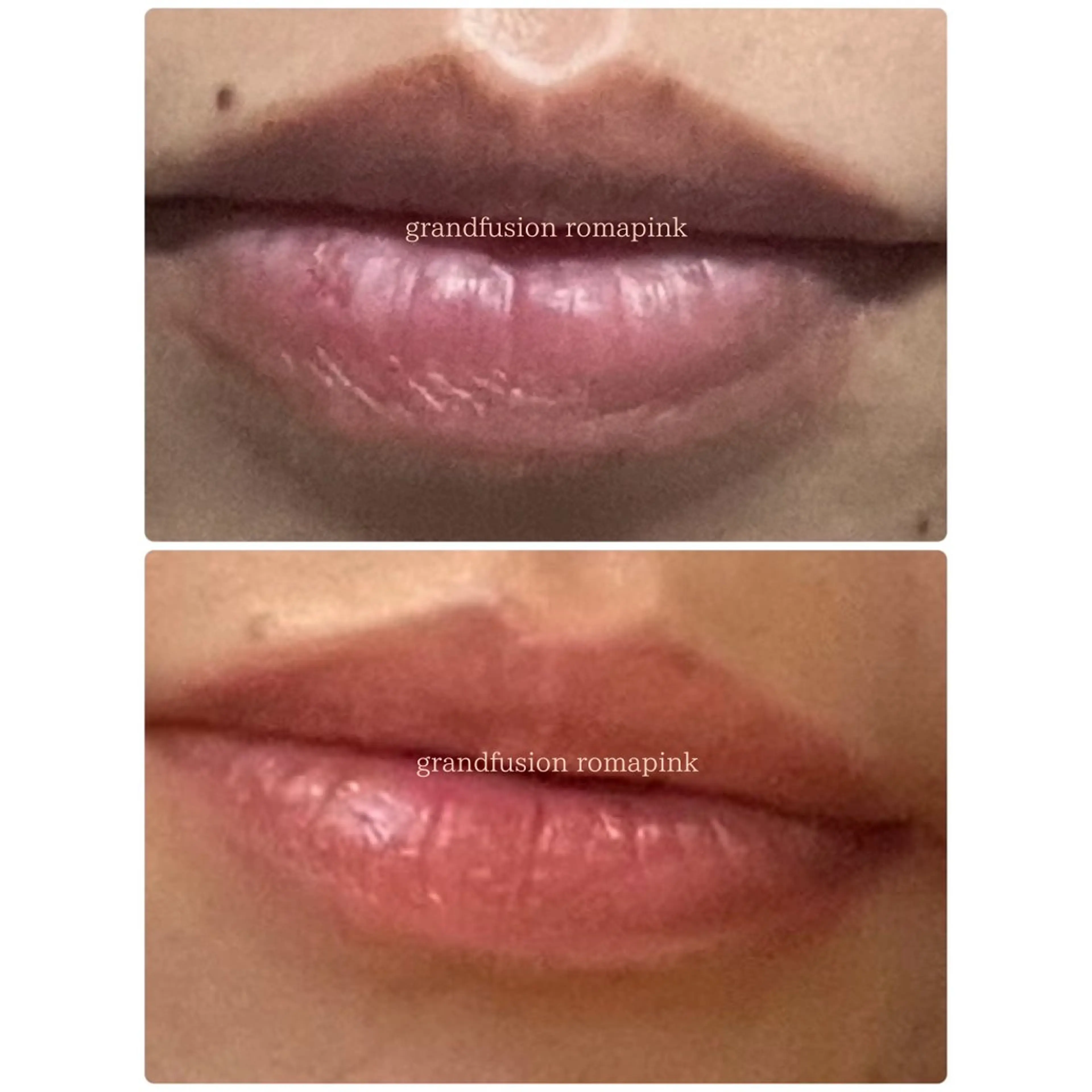 エステ Richeri 代官山のエステ・リラクイメージ