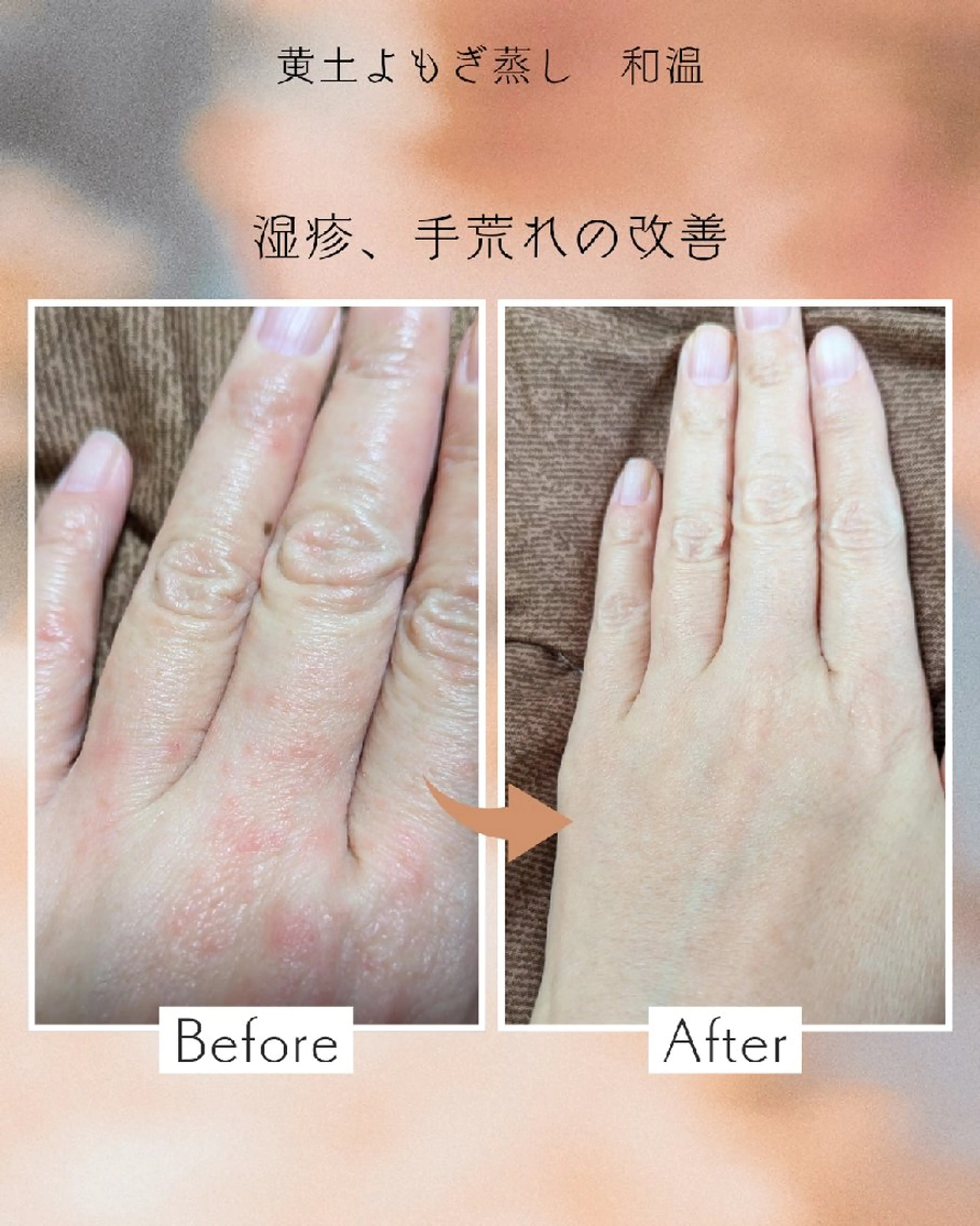 黄土よもぎ蒸し 和温のエステ・リラクイメージ