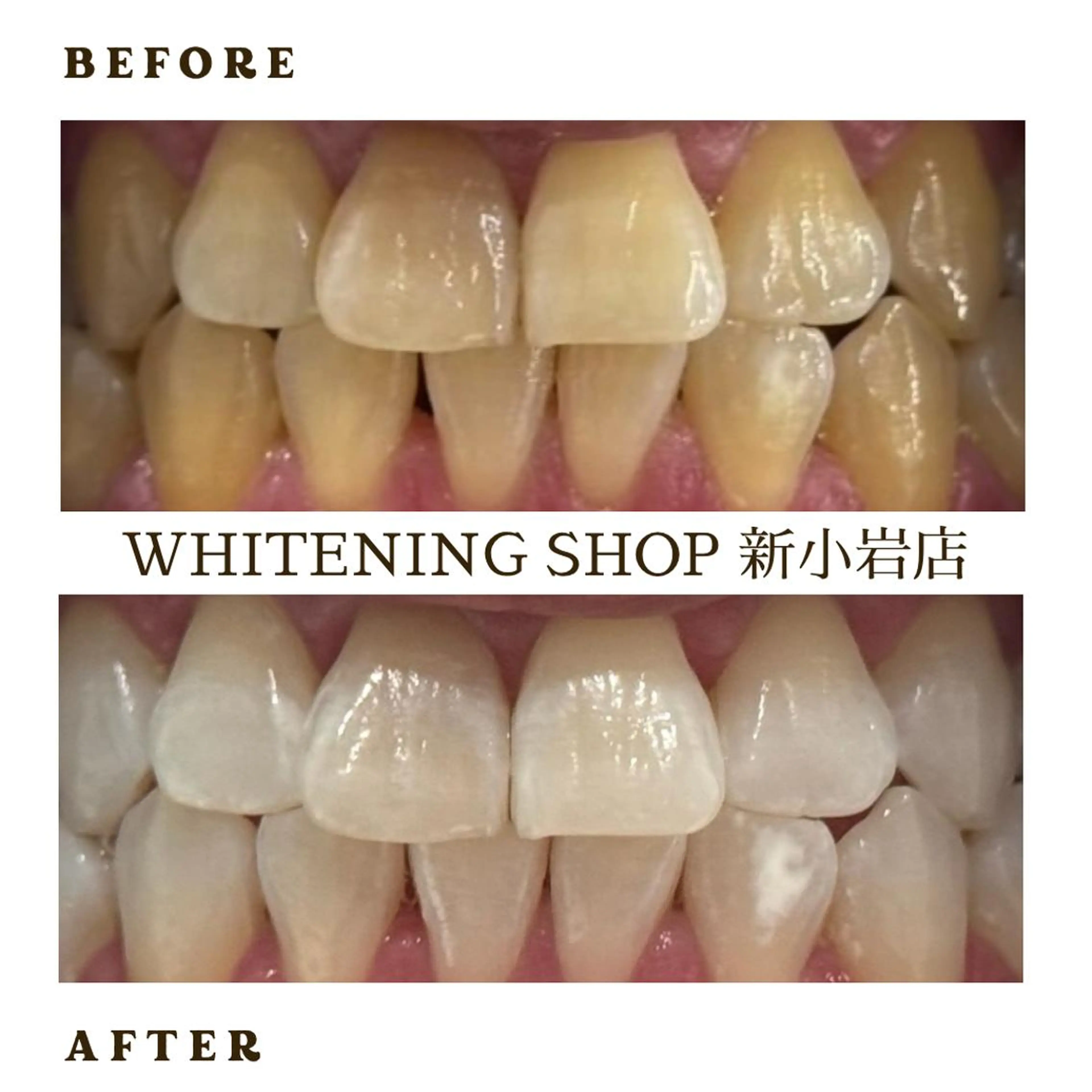 メンズ その他 ホワイトニング ショップ新小岩店のその他イメージ