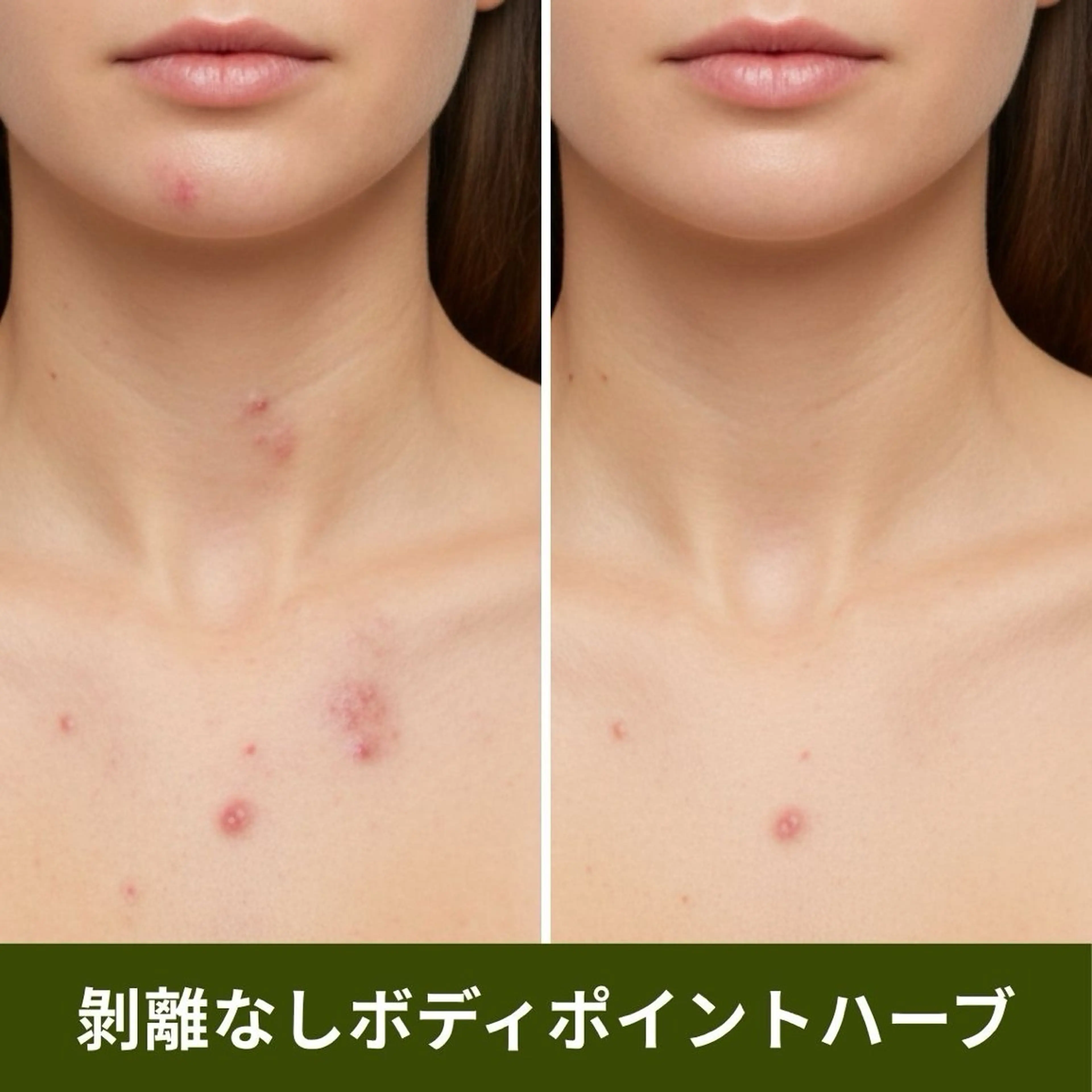 【ポイント施術】ボディハーブピーリング(剥離なし)ヒト幹細胞培養上清液入りハーブ🌿お尻/背中上or下/デコルテ/足/腕の写真