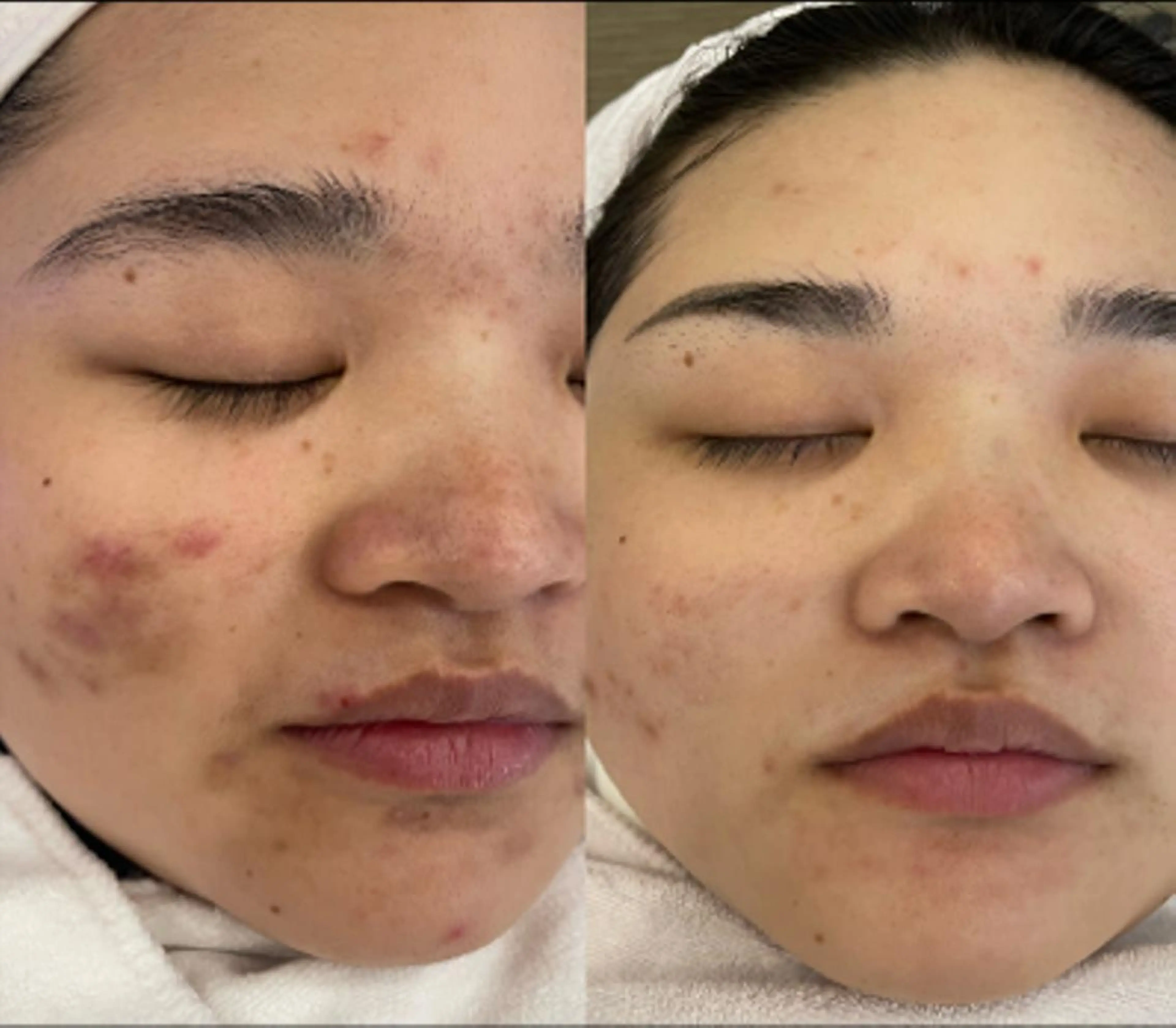 全身脱毛×マッサージ 高岳×新栄×代官町の眉毛・アイブロウイメージ