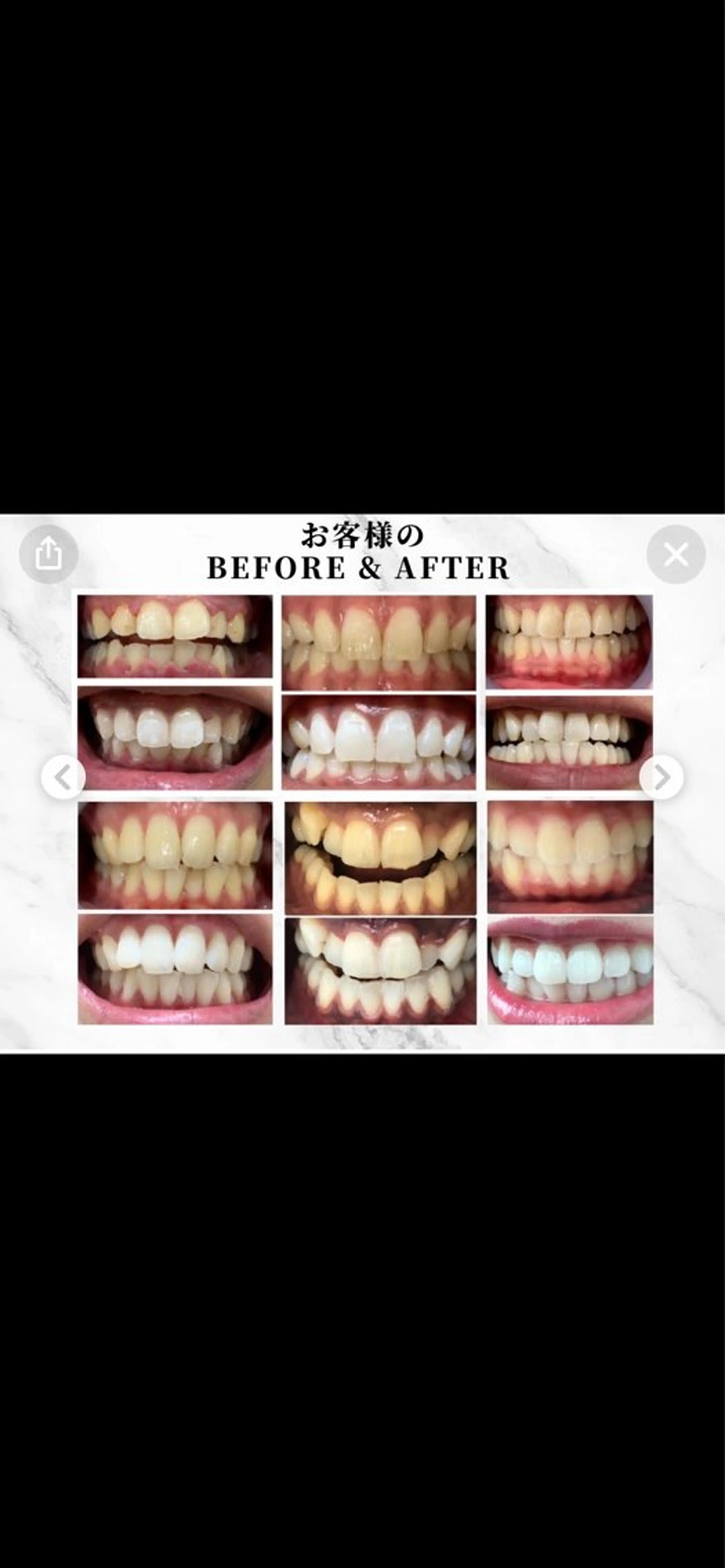 WHITENING ハウスのマツエク・マツパデザイン