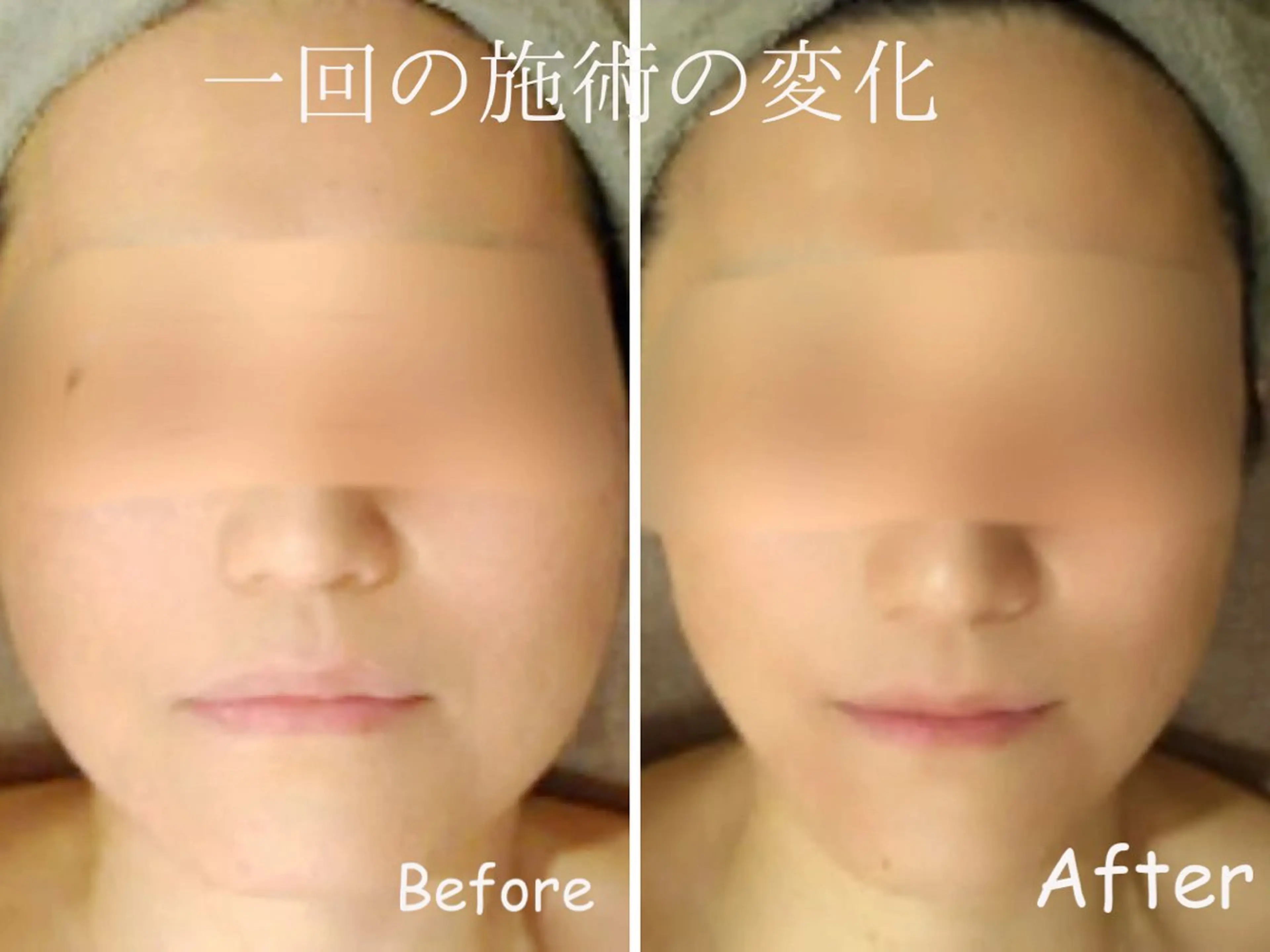 エステ 【歴13年】劇的小顔 D rマジックタッチのエステ・リラクイメージ