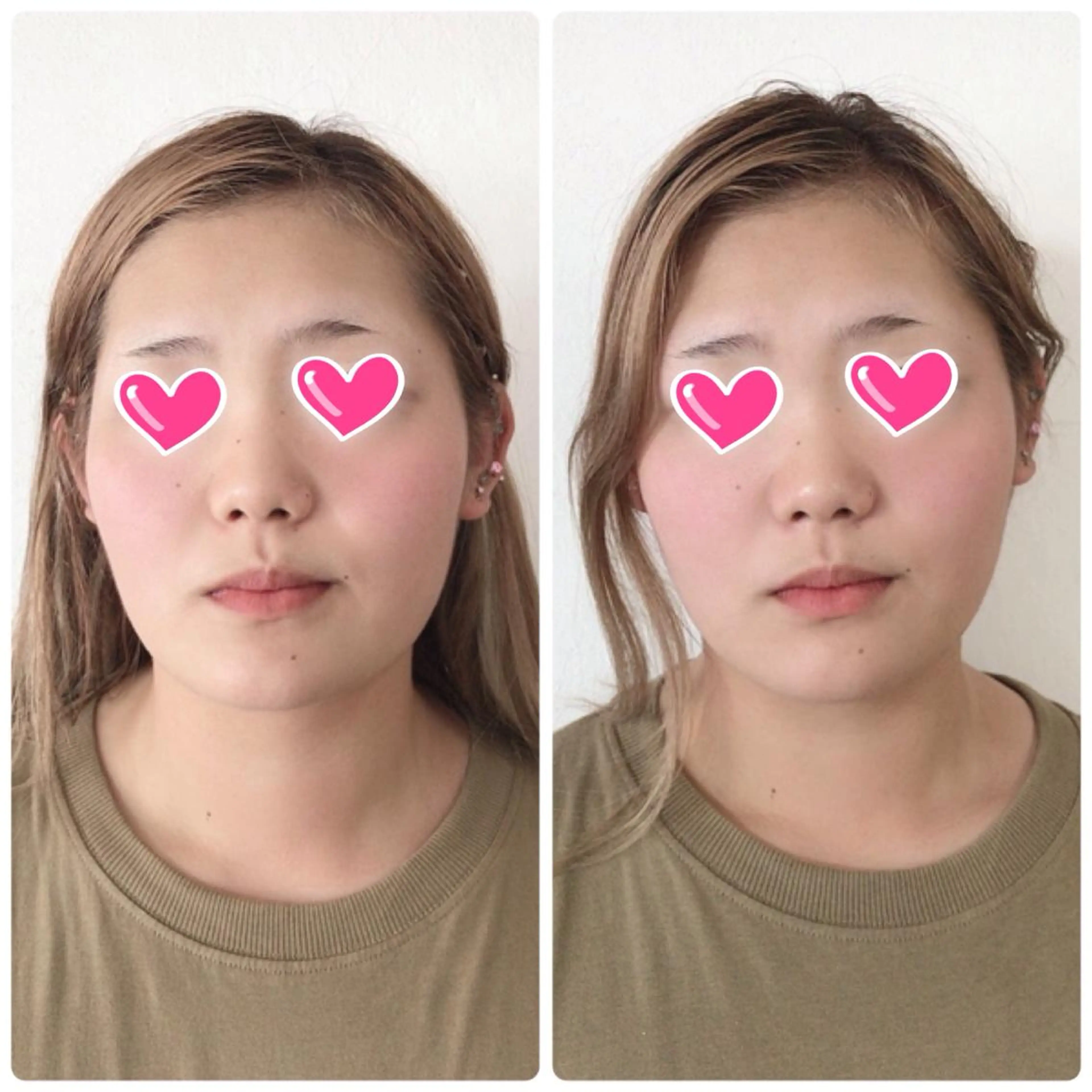 調律エステ /美KISSのその他イメージ