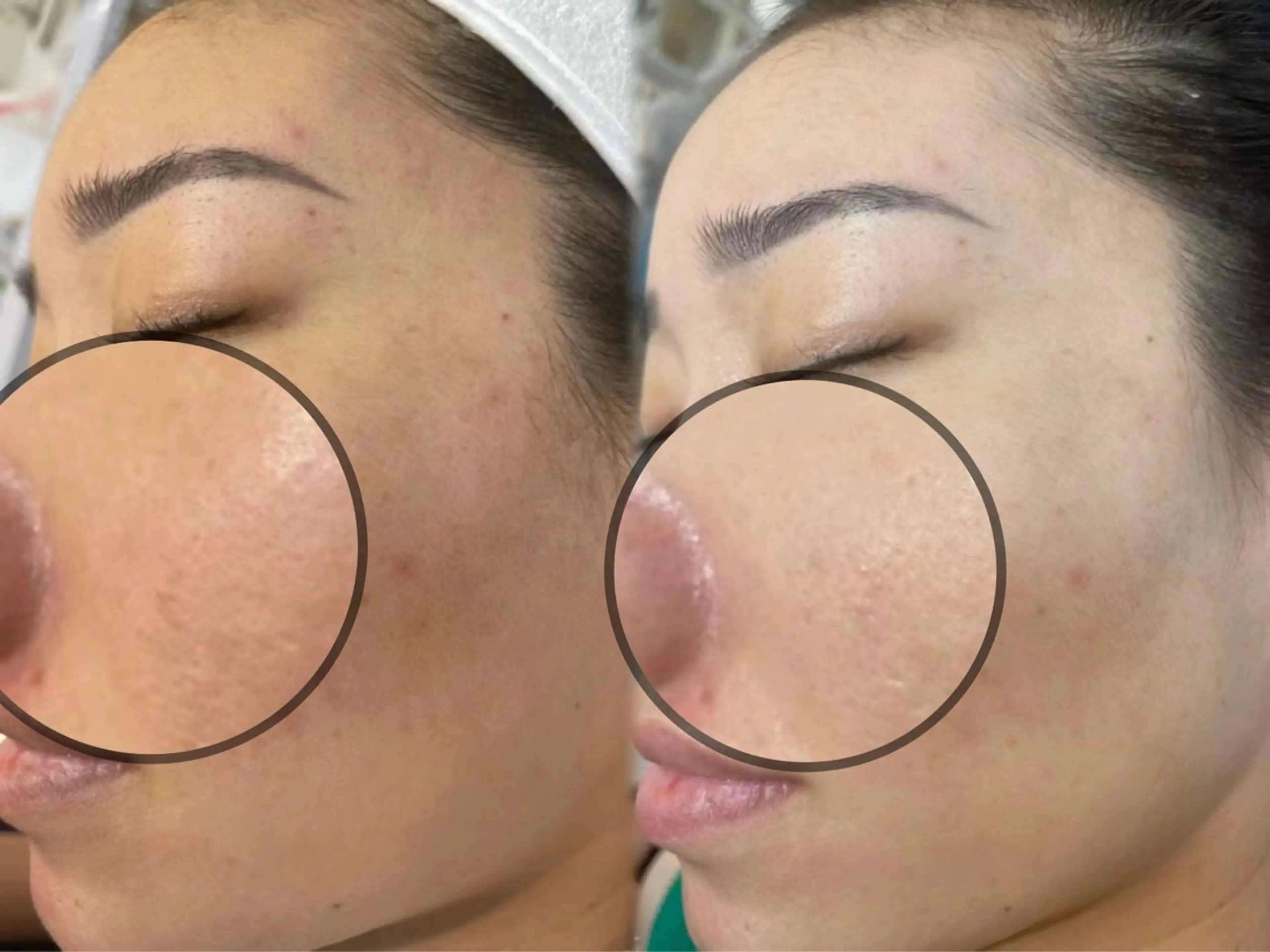 肌管理専門店 Shandeelのエステ・リラクイメージ